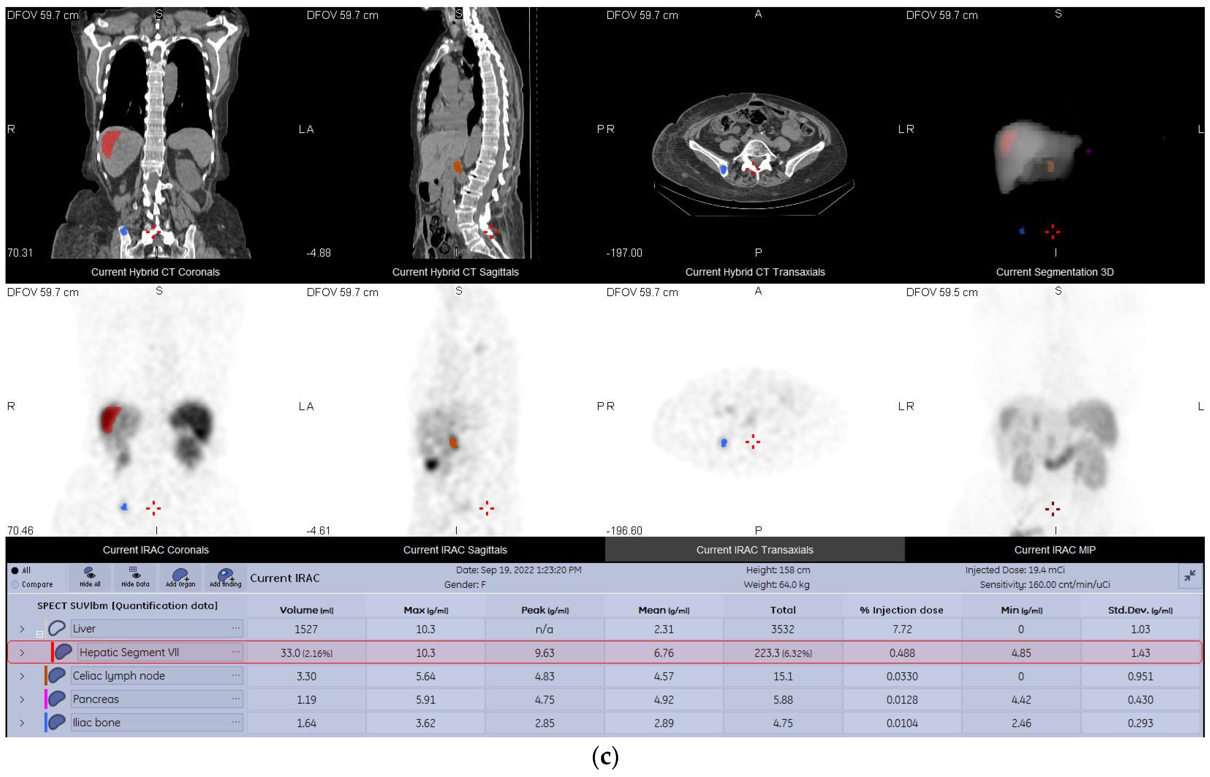 Diagnostics 13 00318 g004b Diagnostics 13 00318 g004b