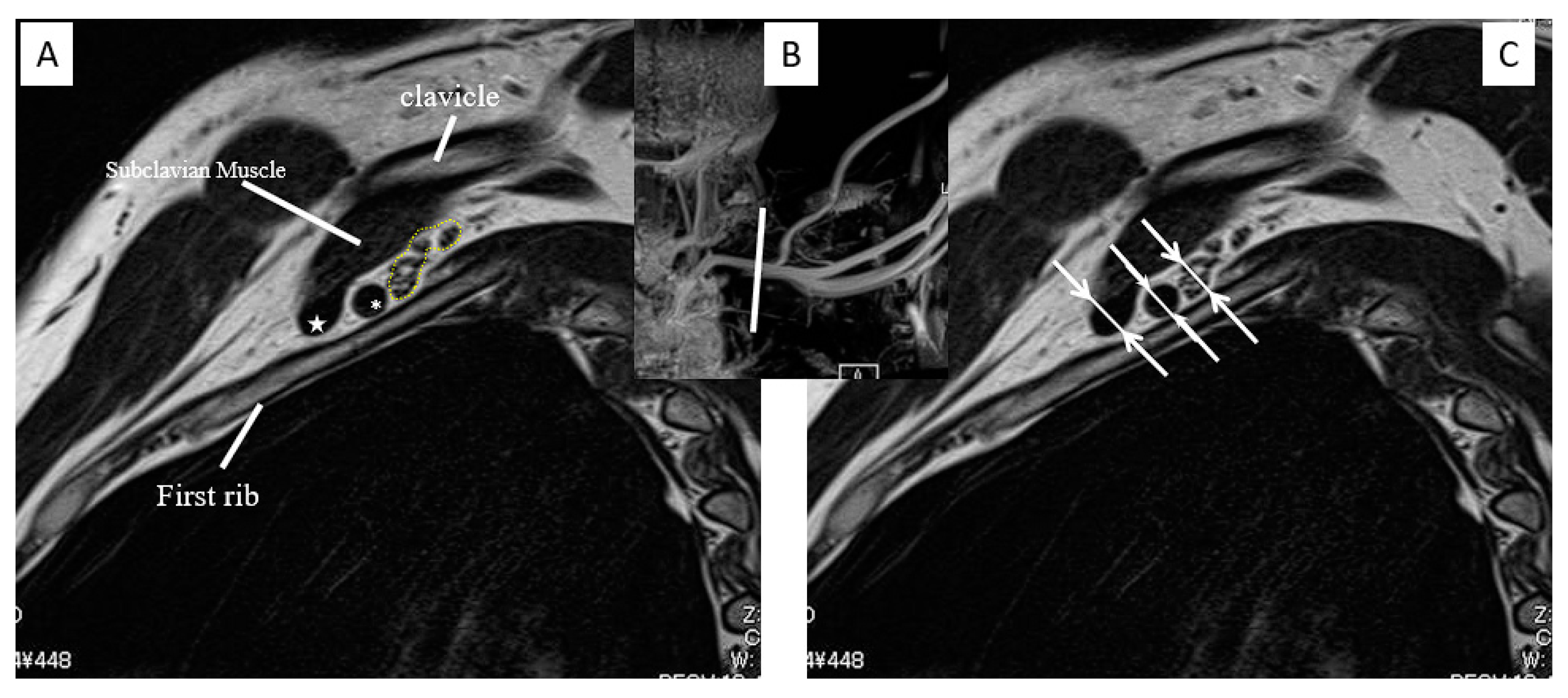 Diagnostics 13 00319 g004 Diagnostics 13 00319 g004