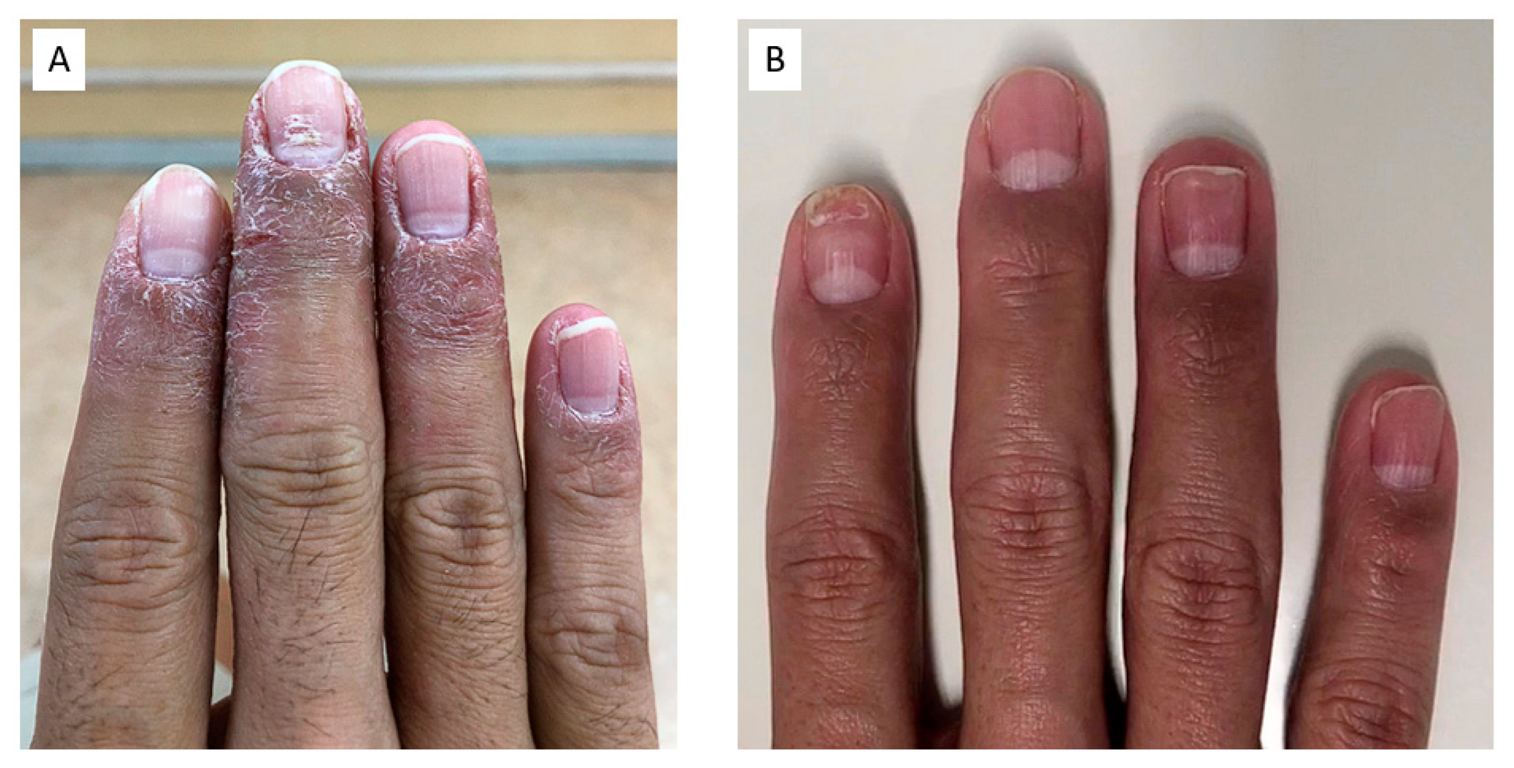 Diagnostics 13 00319 g005 Diagnostics 13 00319 g005