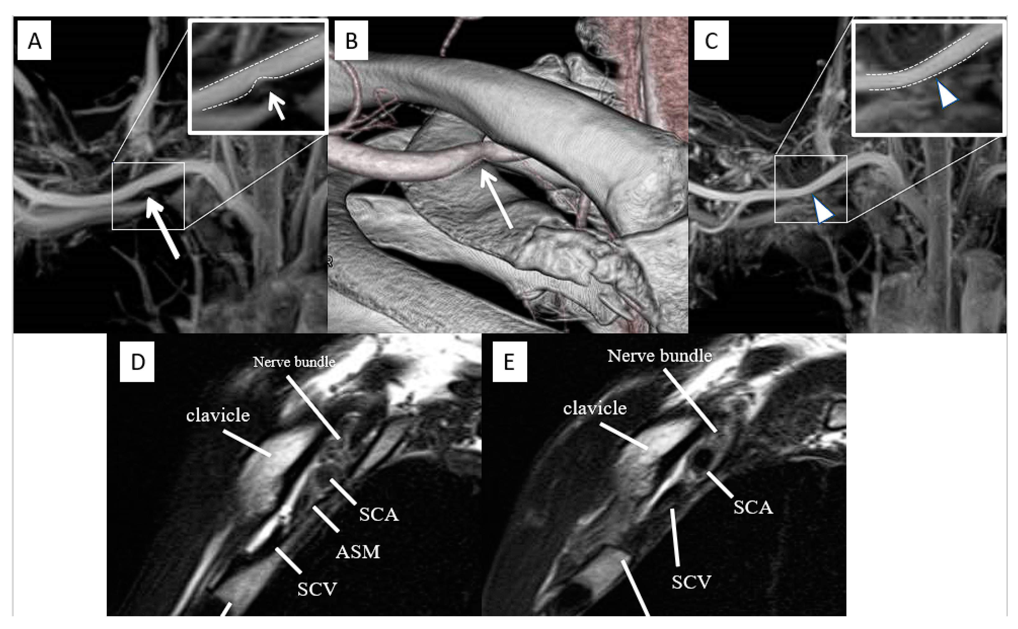 Diagnostics 13 00319 g006 Diagnostics 13 00319 g006