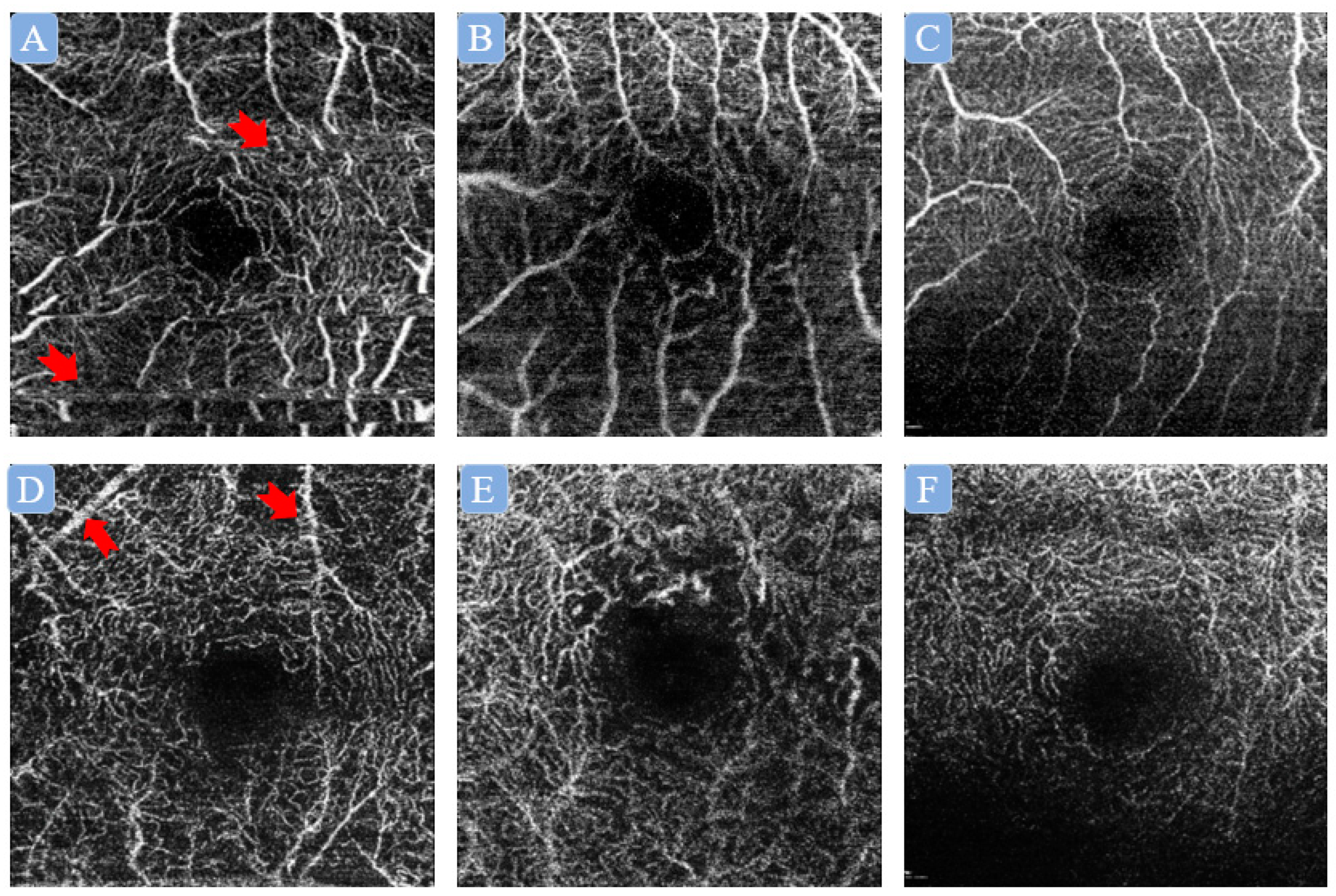 Diagnostics 13 00326 g002