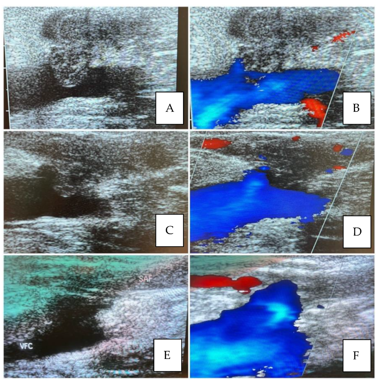 Diagnostics 13 00327 g003