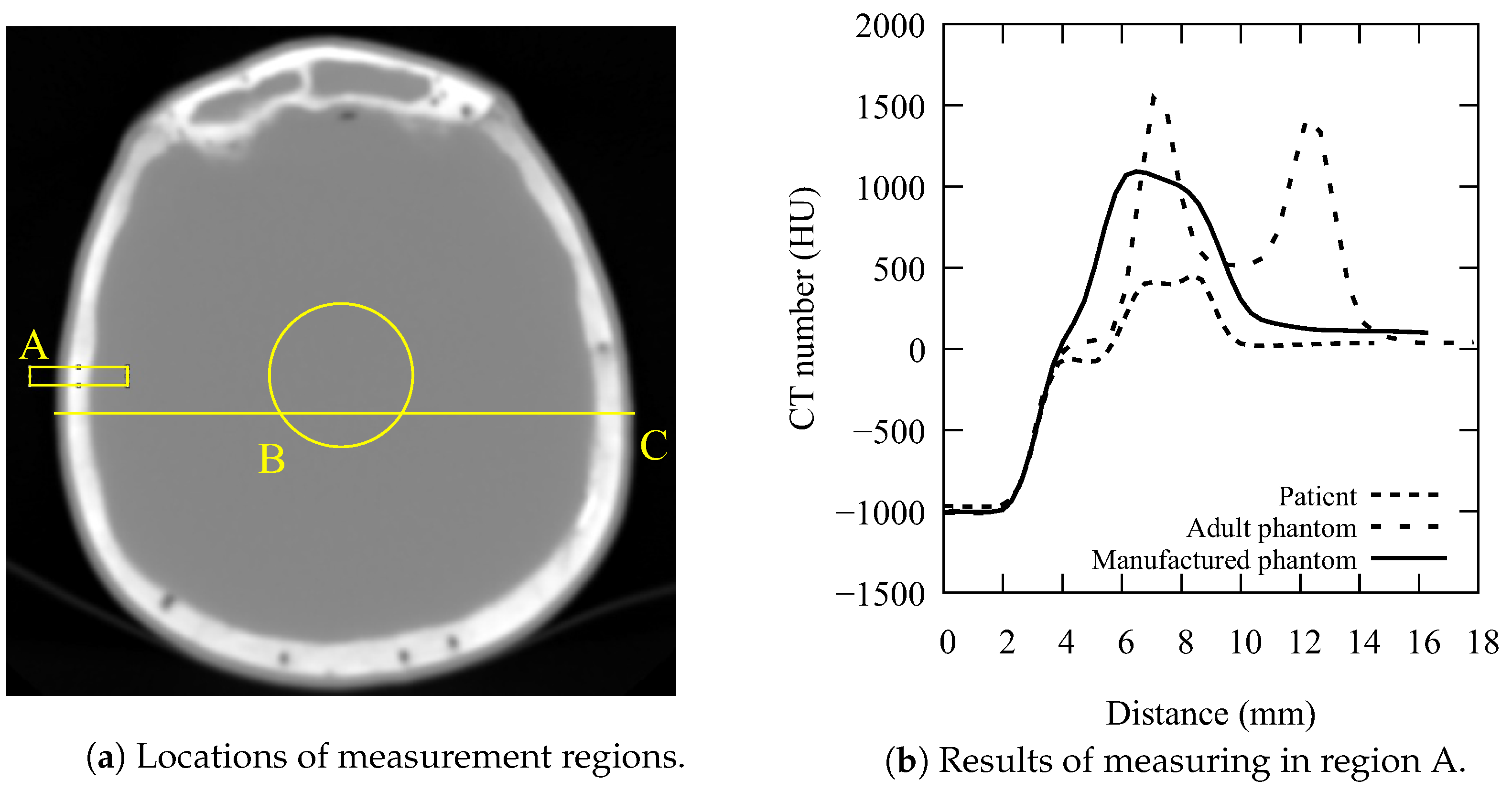 Diagnostics 13 00328 g002 Diagnostics 13 00328 g002