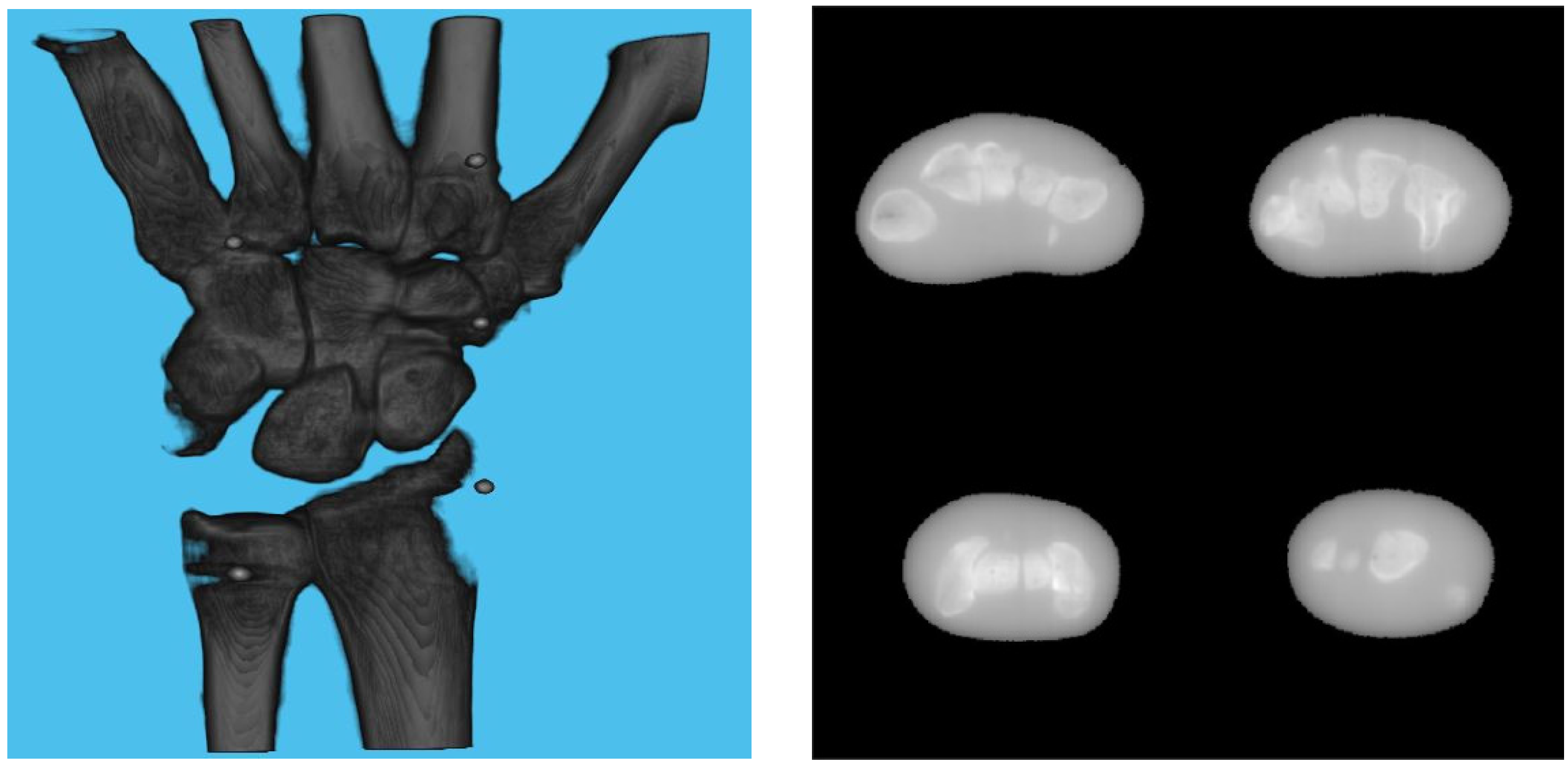 Diagnostics 13 00330 g007 Diagnostics 13 00330 g007