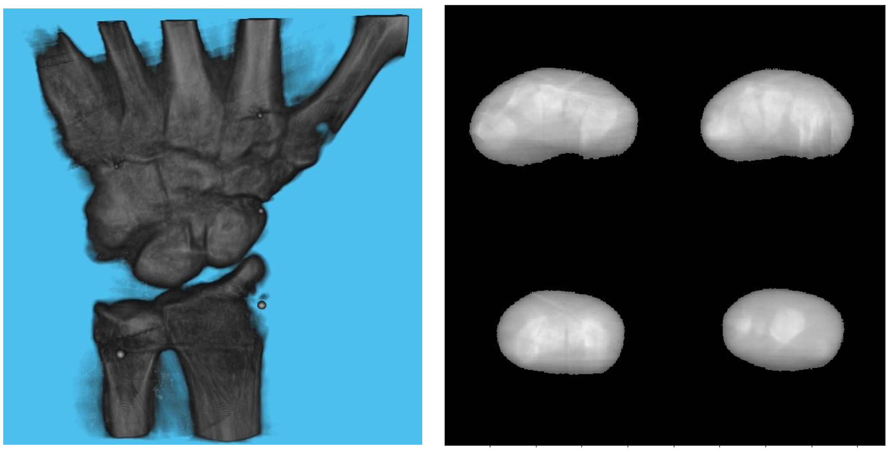 Diagnostics 13 00330 g011 Diagnostics 13 00330 g011