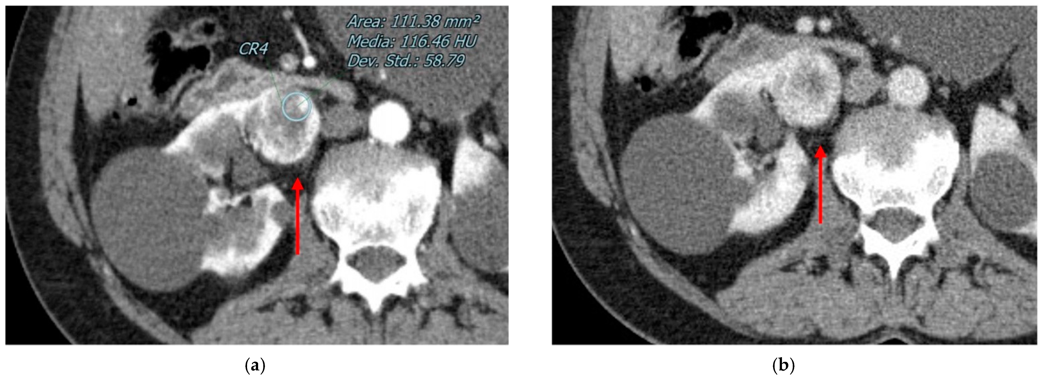 Diagnostics 13 00334 g002 Diagnostics 13 00334 g002