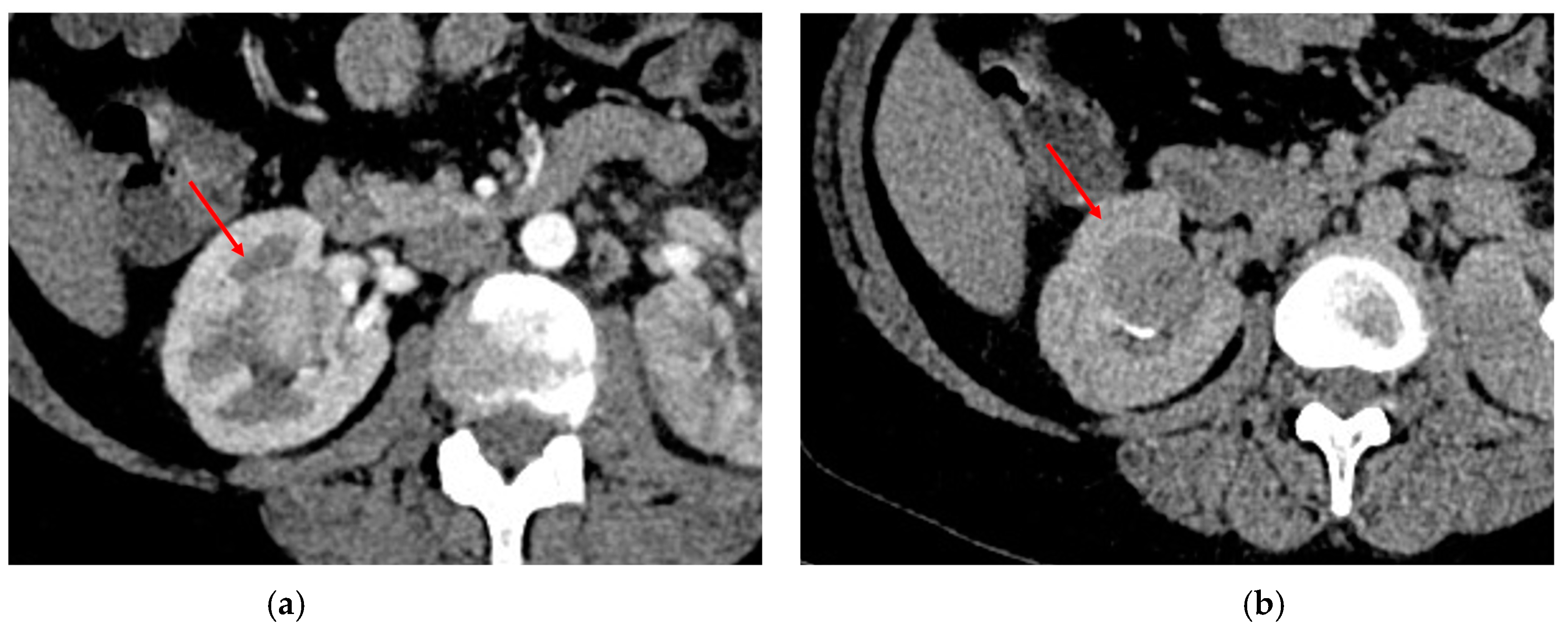 Diagnostics 13 00334 g003 Diagnostics 13 00334 g003