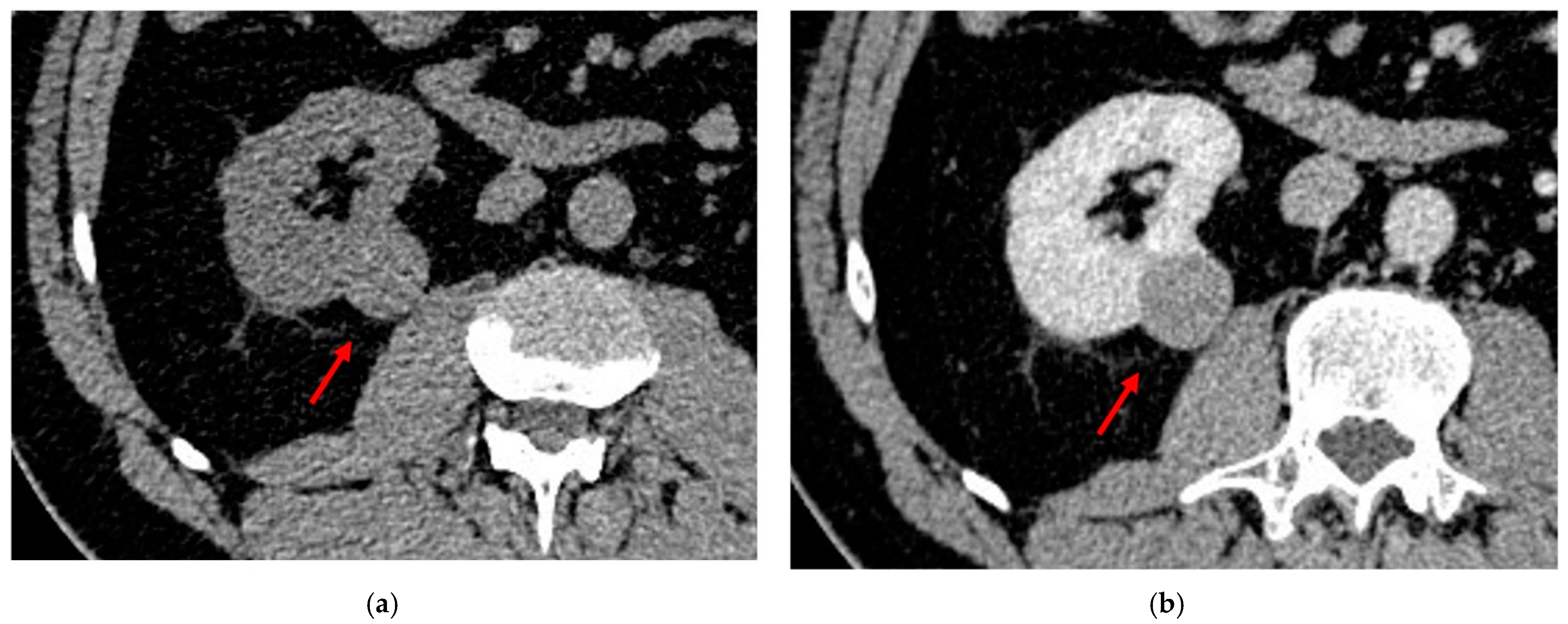 Diagnostics 13 00334 g005 Diagnostics 13 00334 g005