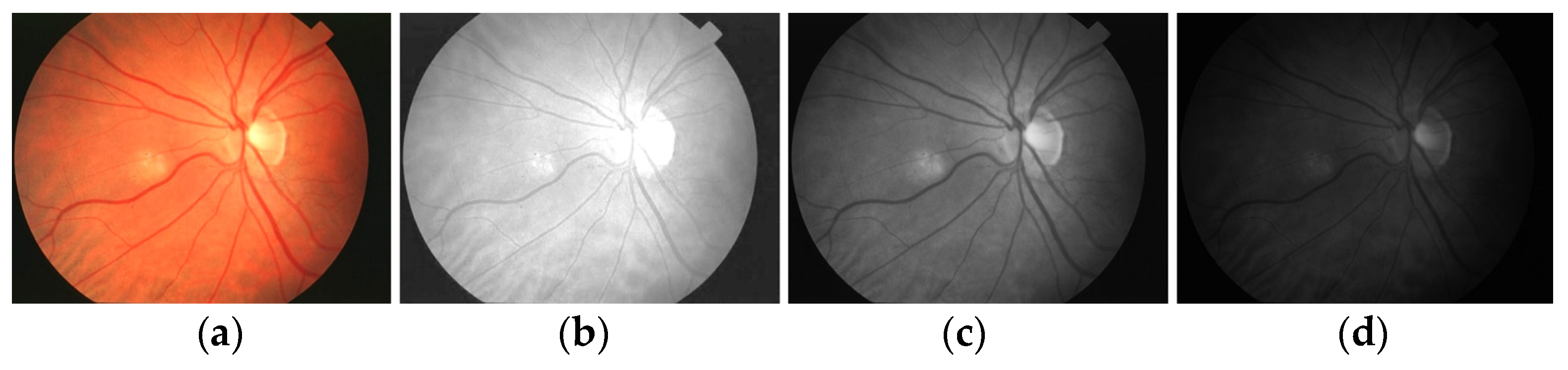 Diagnostics 13 00342 g005