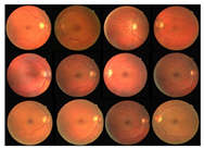 Diagnostics 13 00342 i001