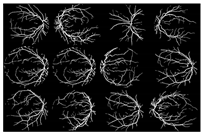 Diagnostics 13 00342 i003