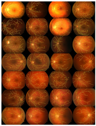 Diagnostics 13 00342 i012