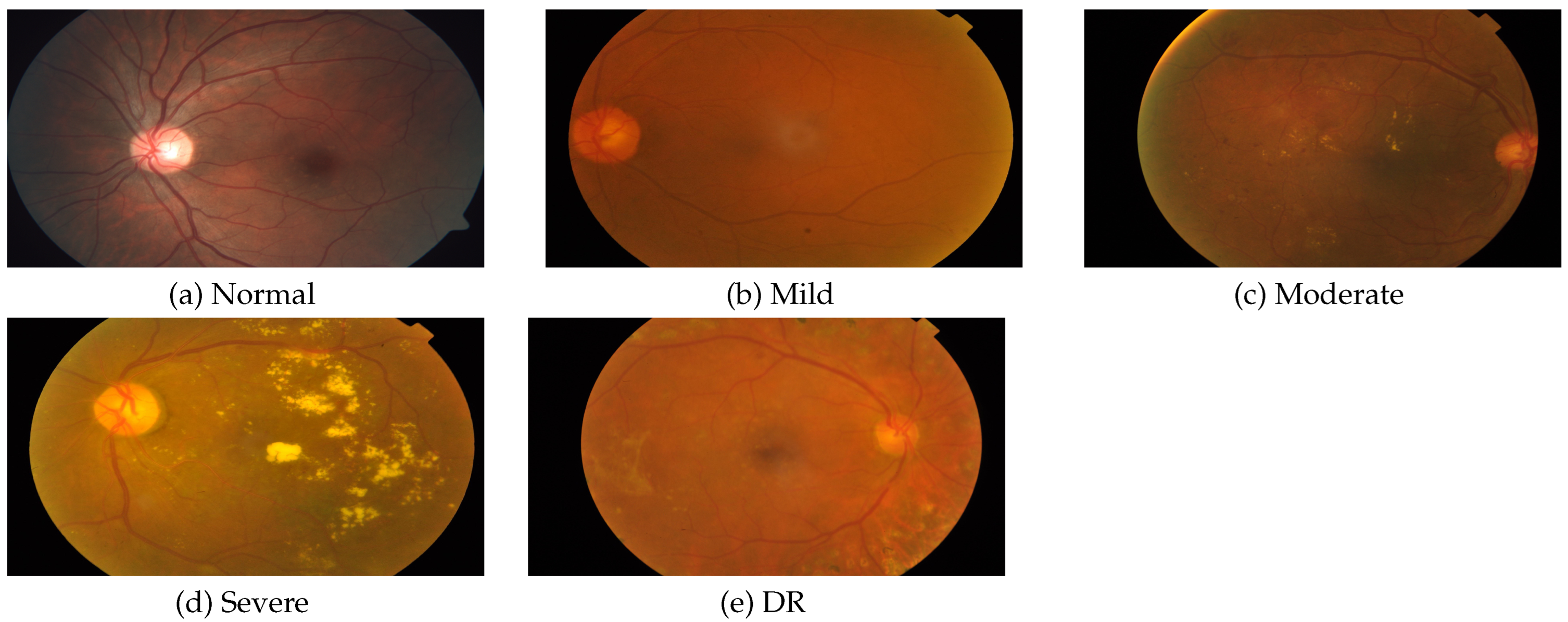 Diagnostics 13 00345 g004