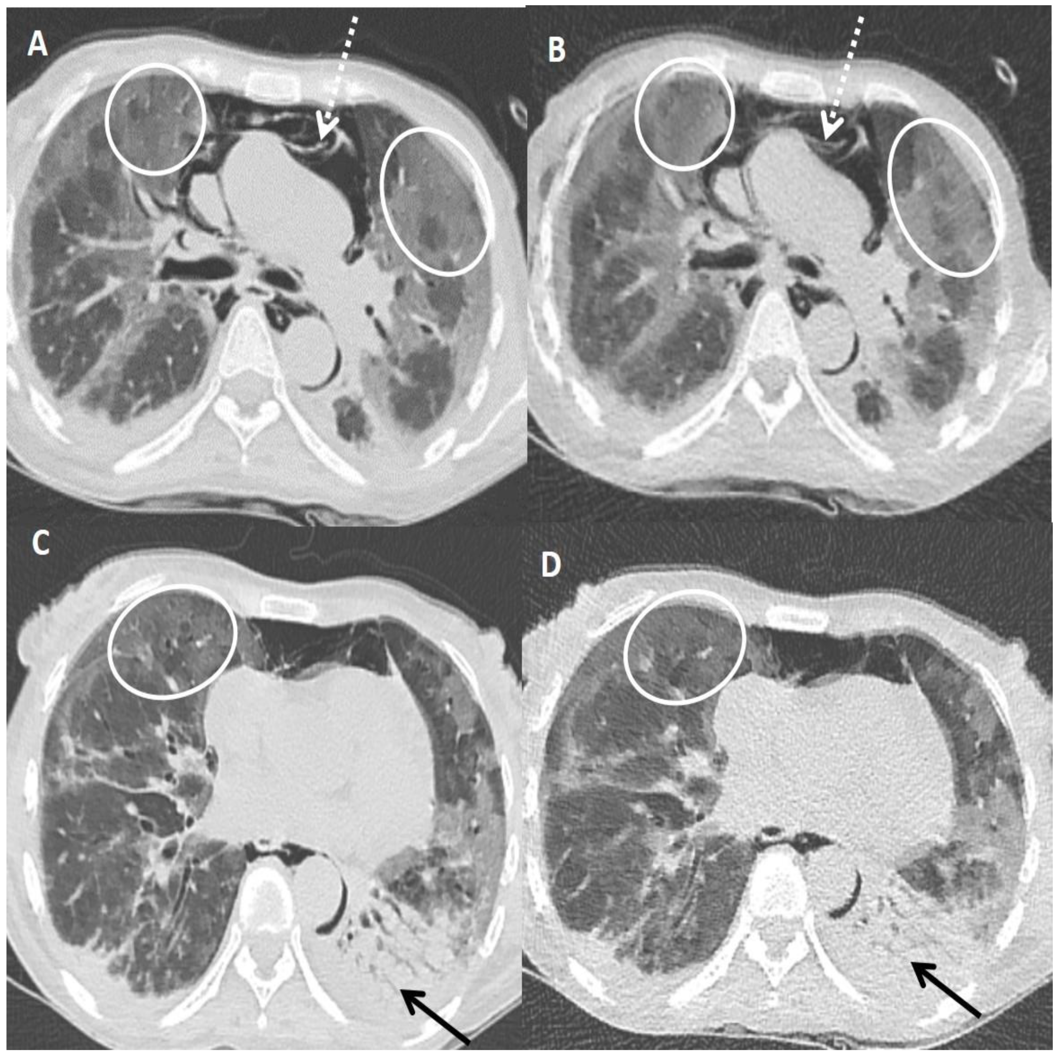 Diagnostics 13 00351 g003