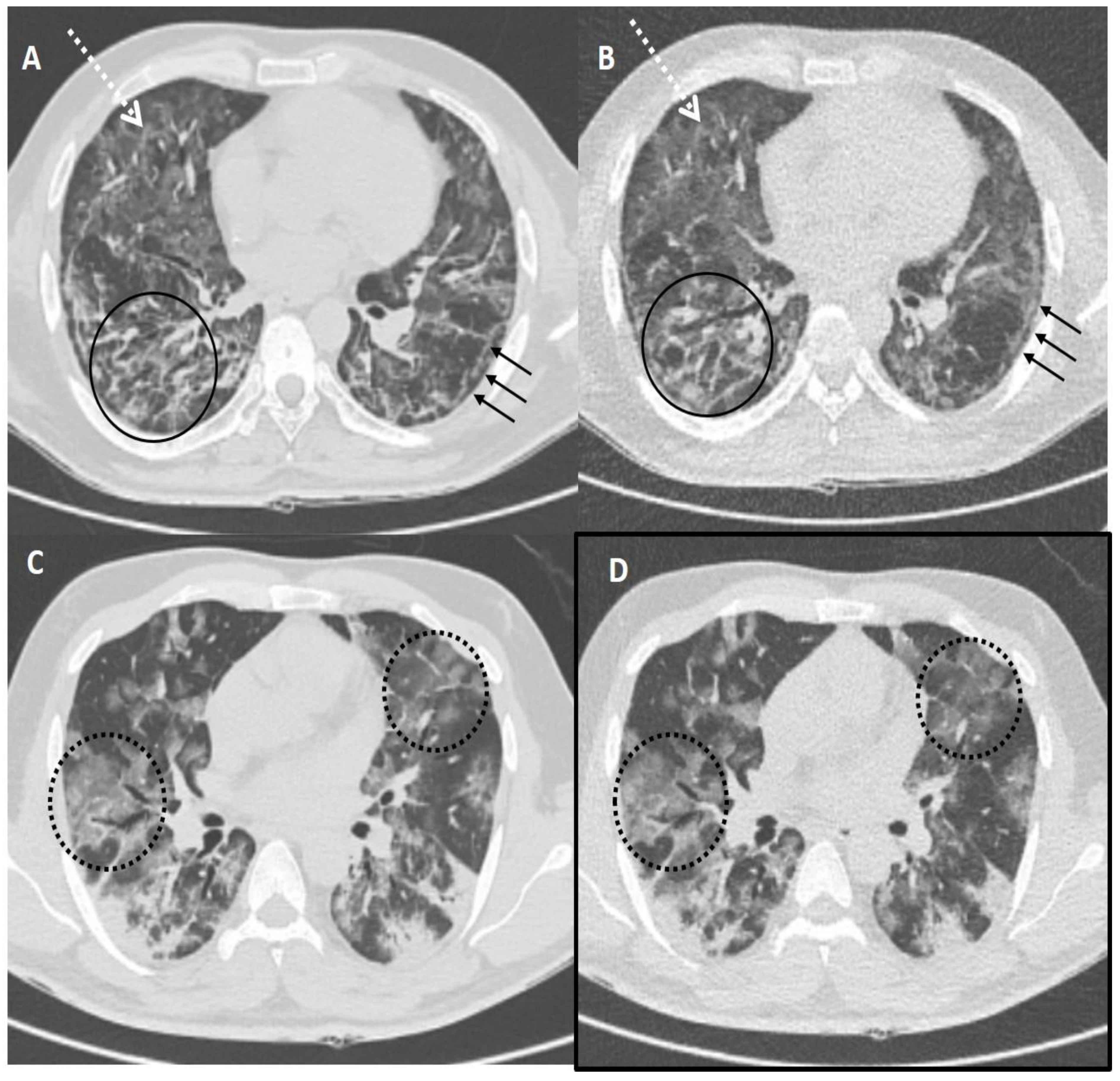 Diagnostics 13 00351 g004