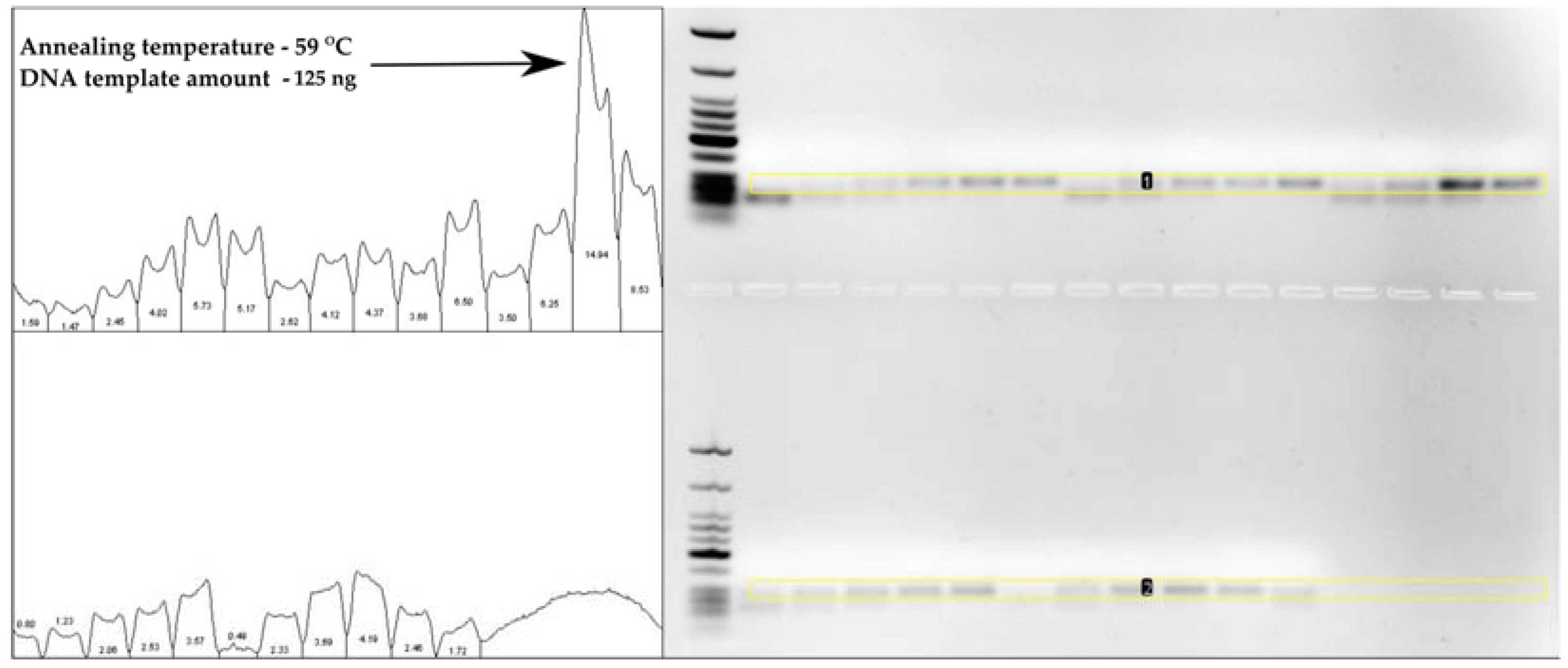 Diagnostics 13 00360 g002 Diagnostics 13 00360 g002