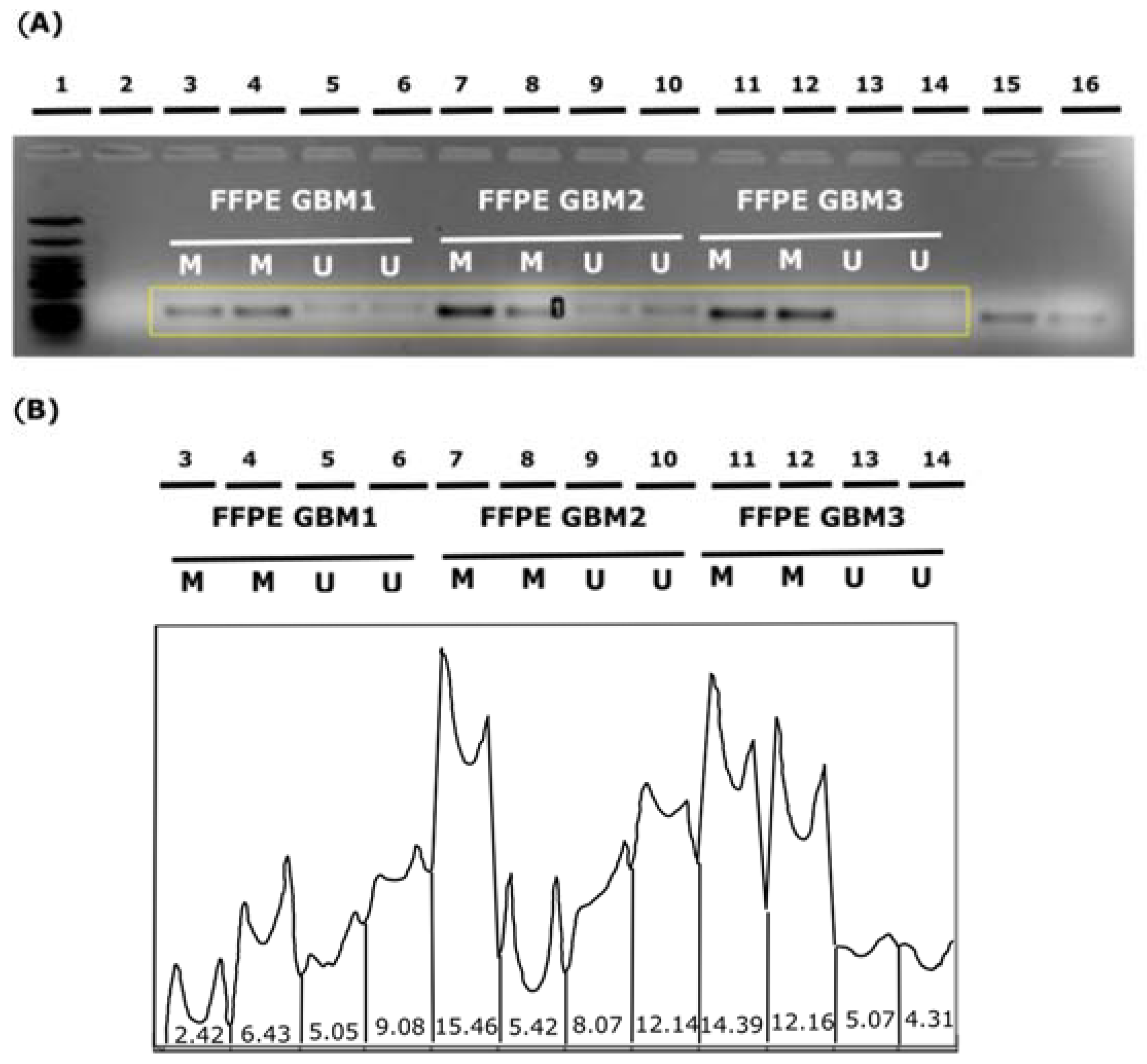 Diagnostics 13 00360 g004 Diagnostics 13 00360 g004