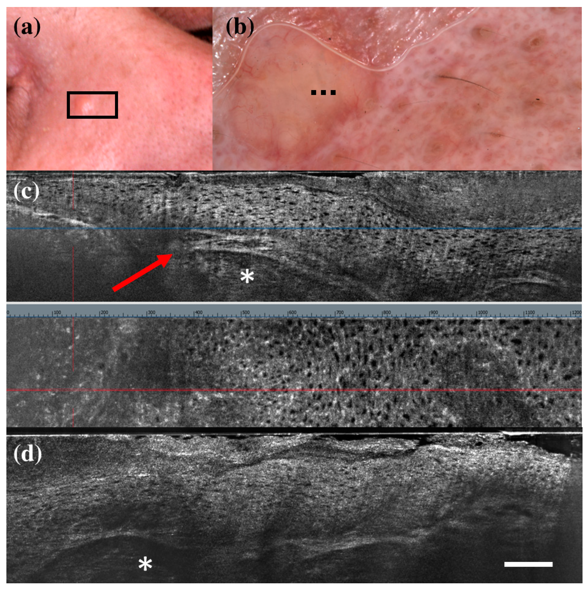 Diagnostics 13 00361 g003