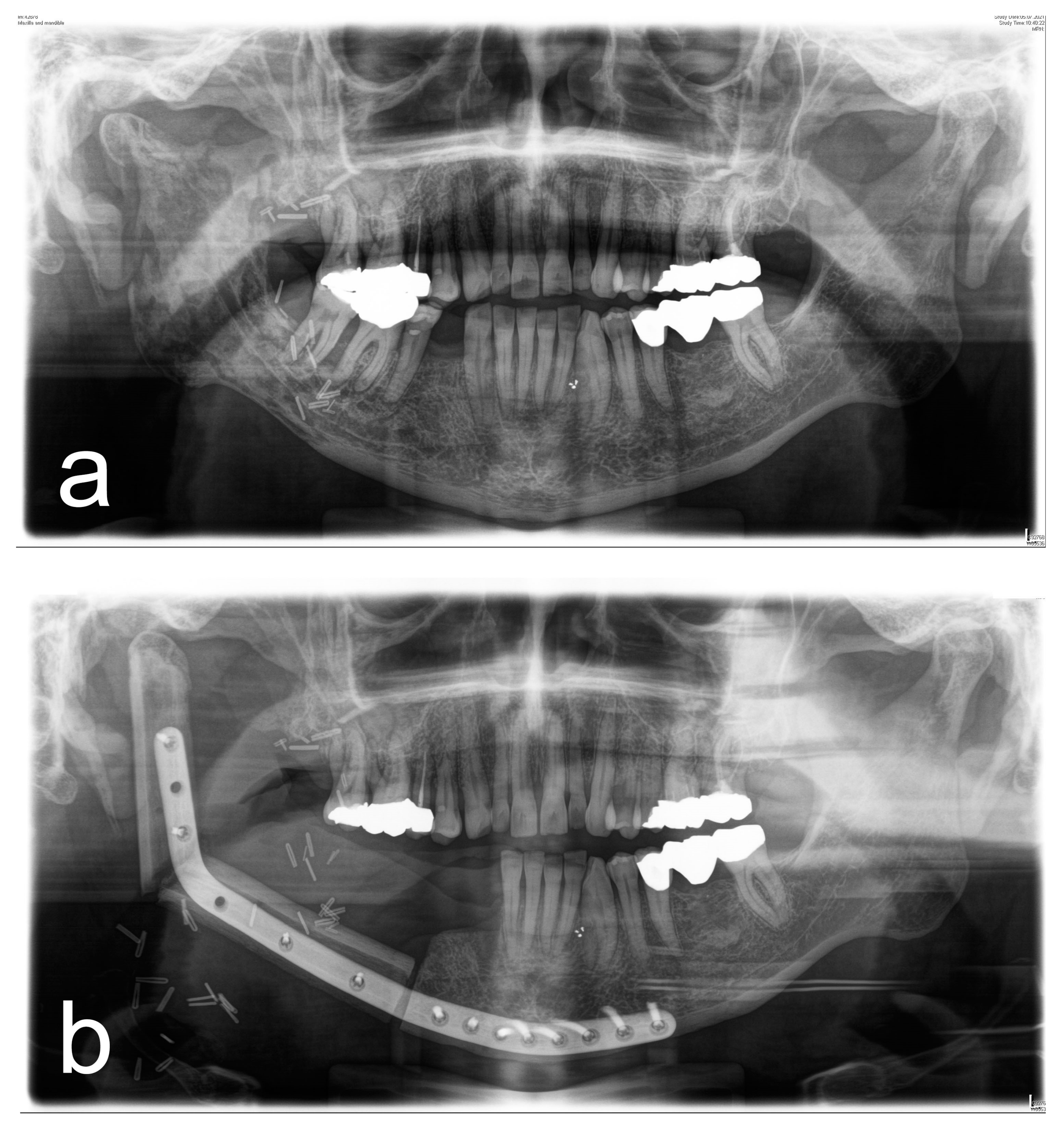Diagnostics 13 00366 g001