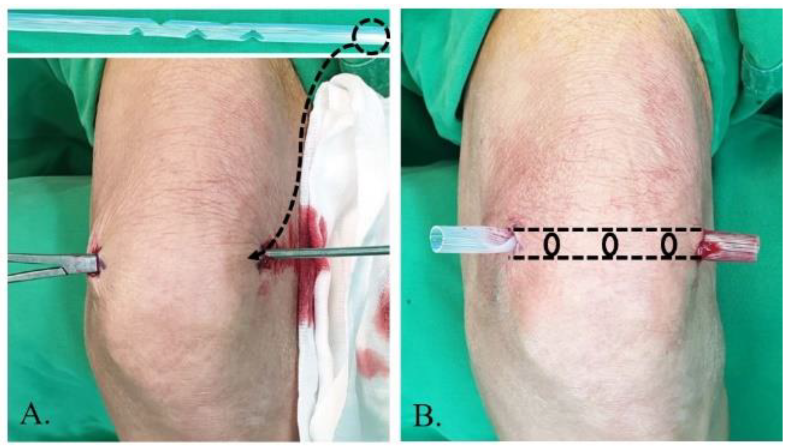 Diagnostics 13 00371 g002