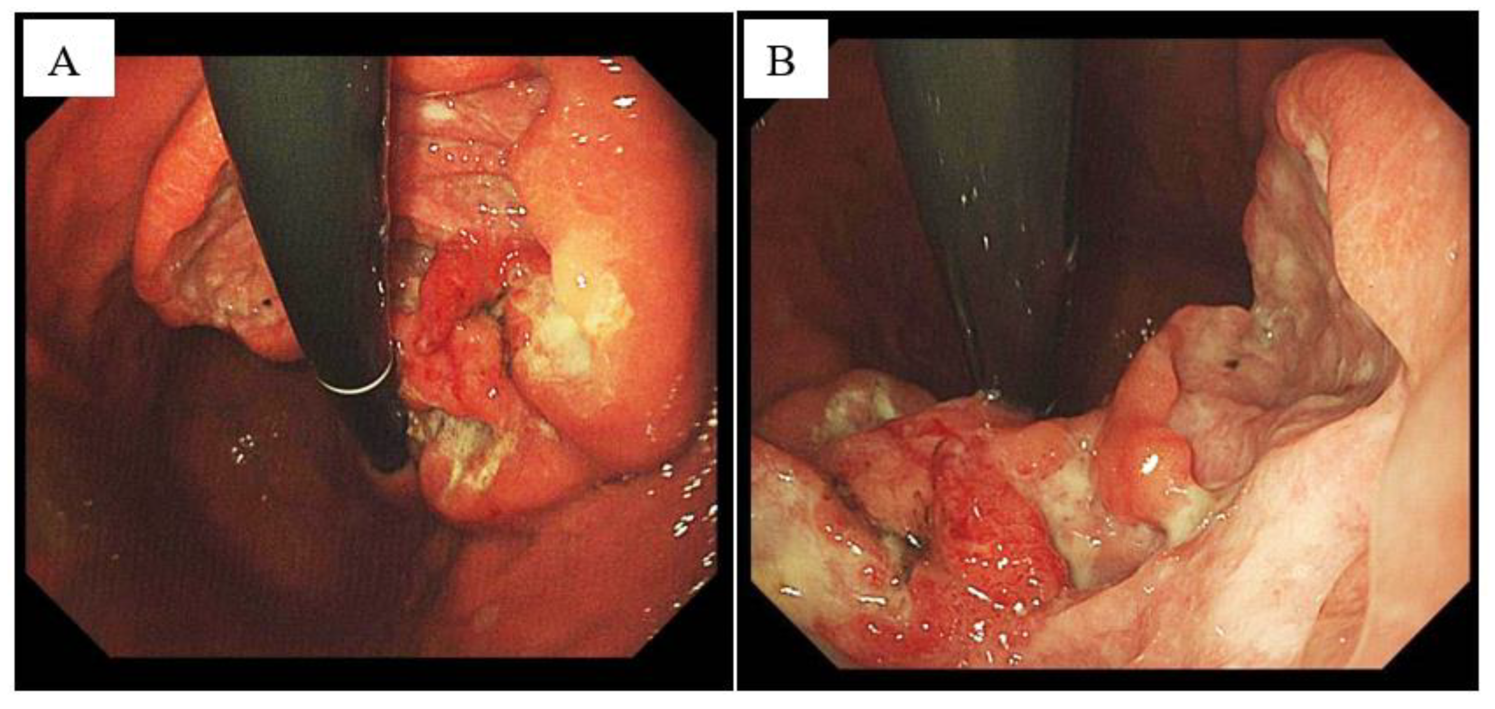 Diagnostics 13 00376 g001 Diagnostics 13 00376 g001