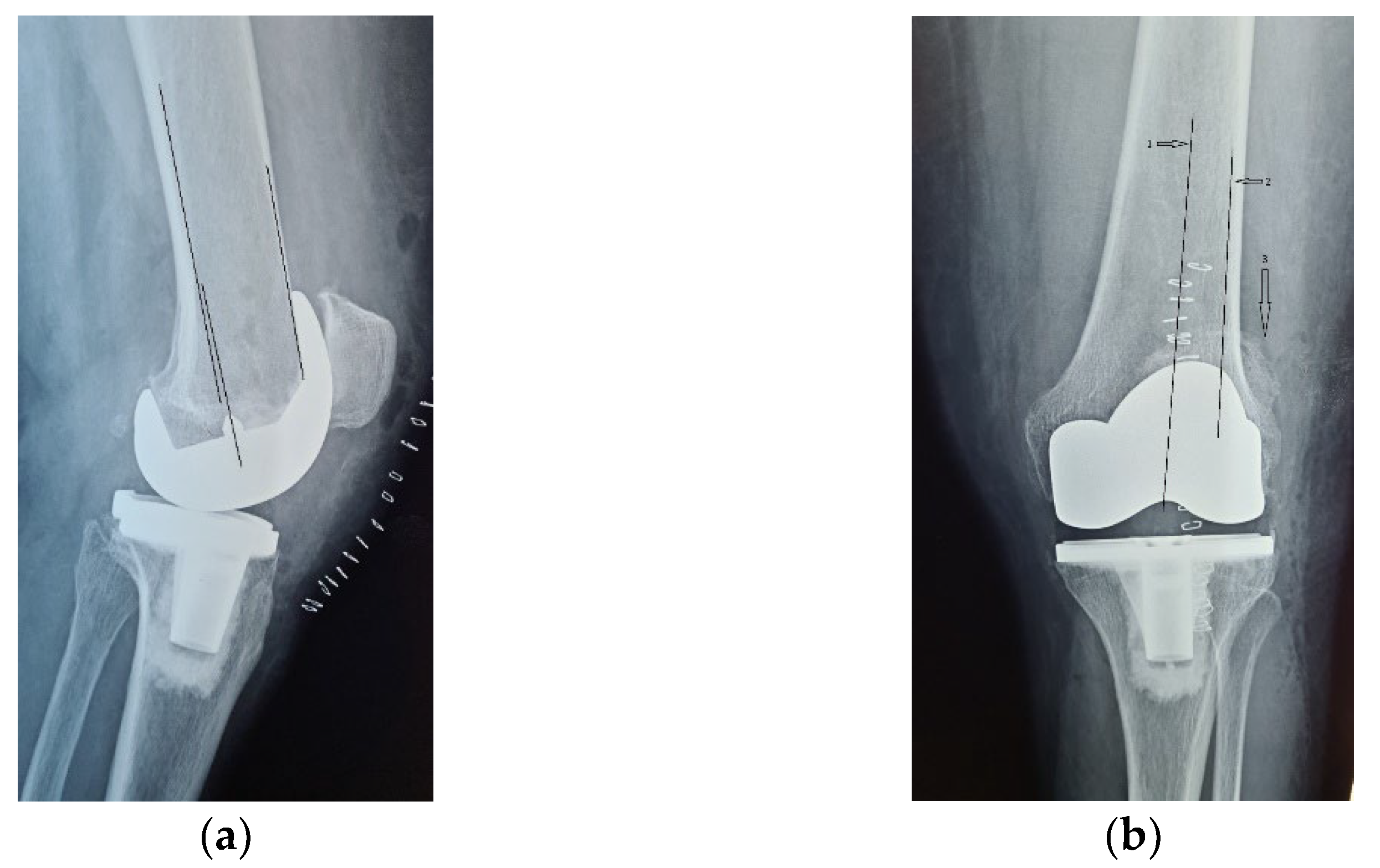 Diagnostics 13 00383 g002