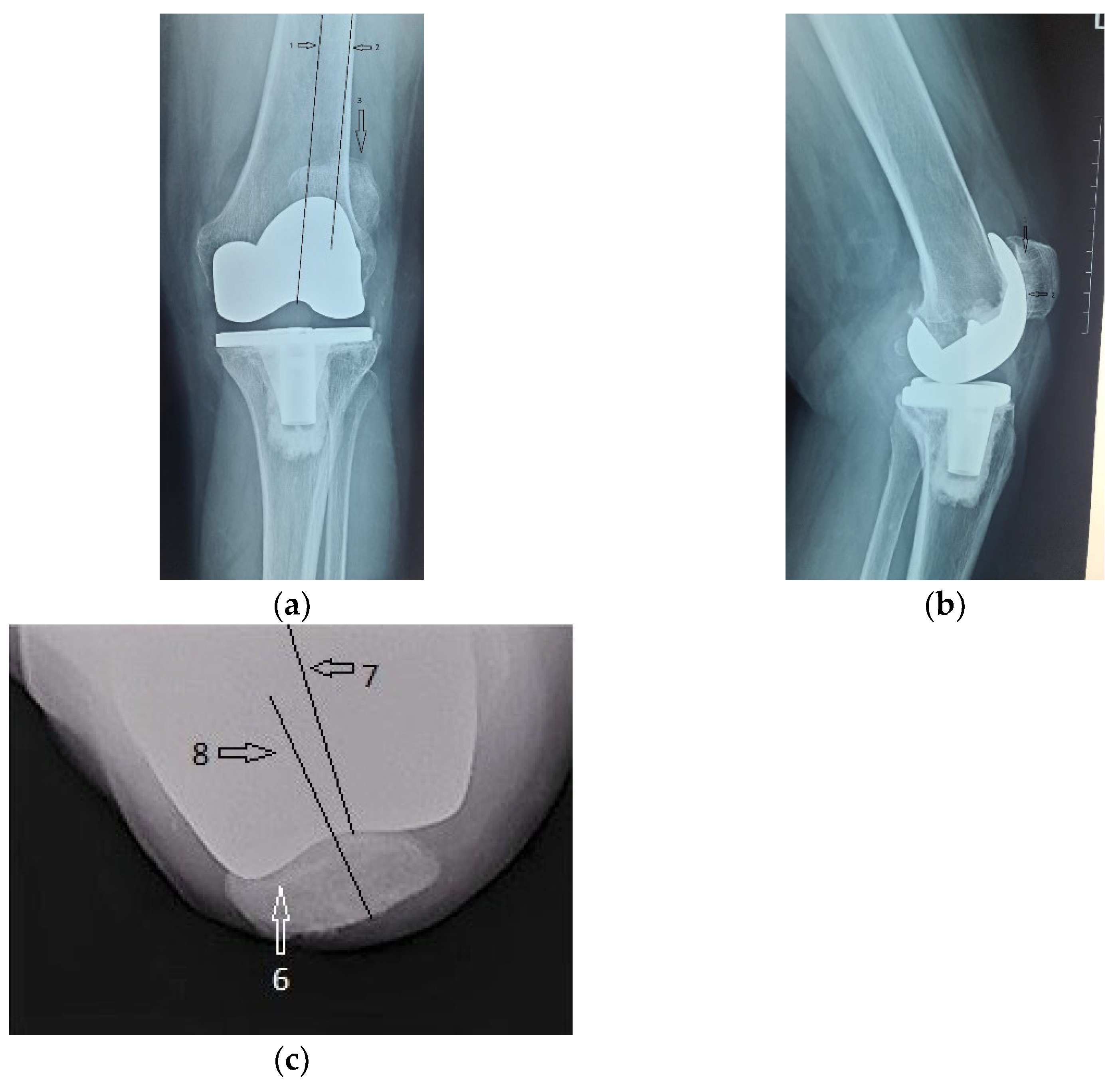 Diagnostics 13 00383 g004