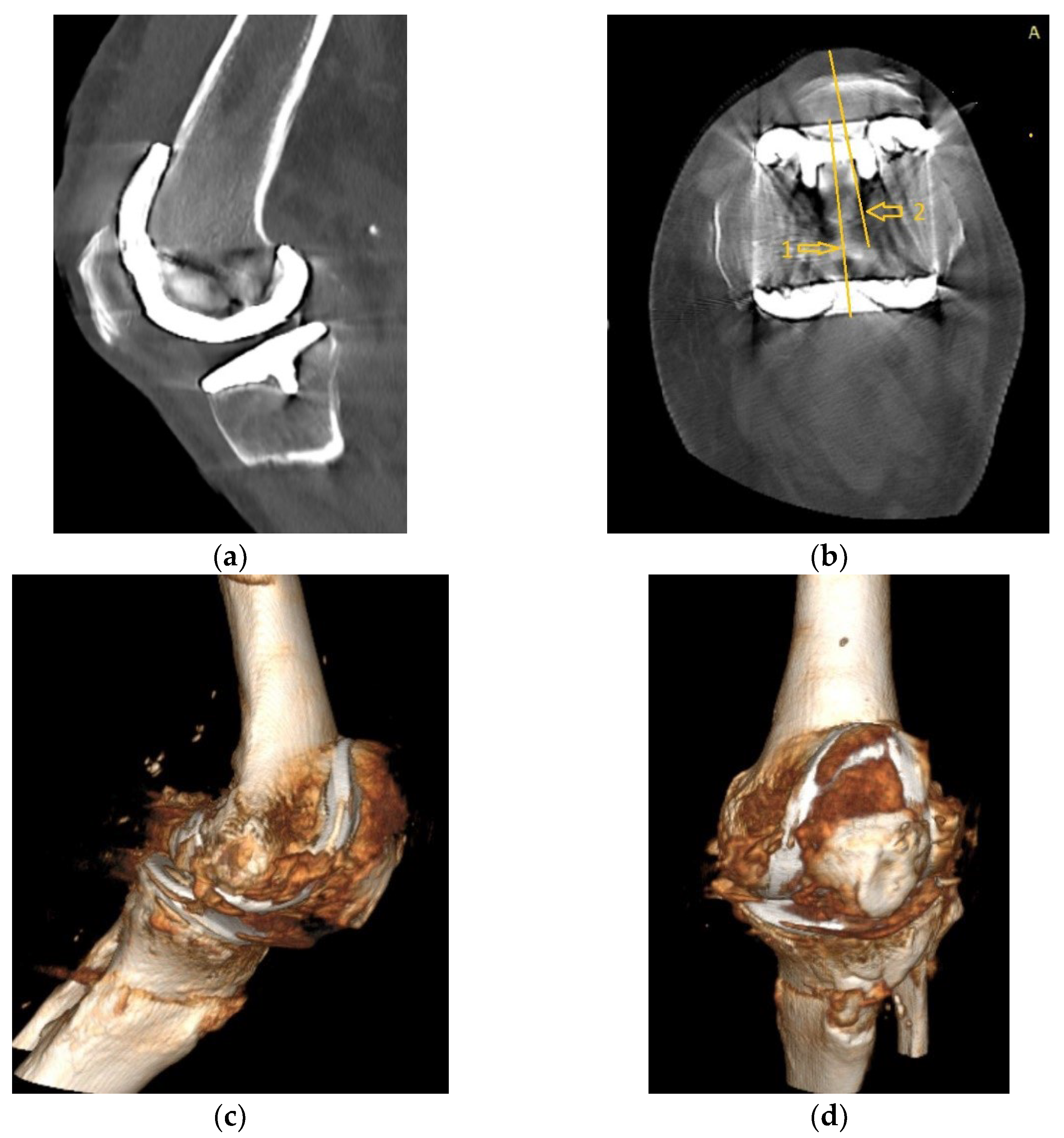 Diagnostics 13 00383 g005