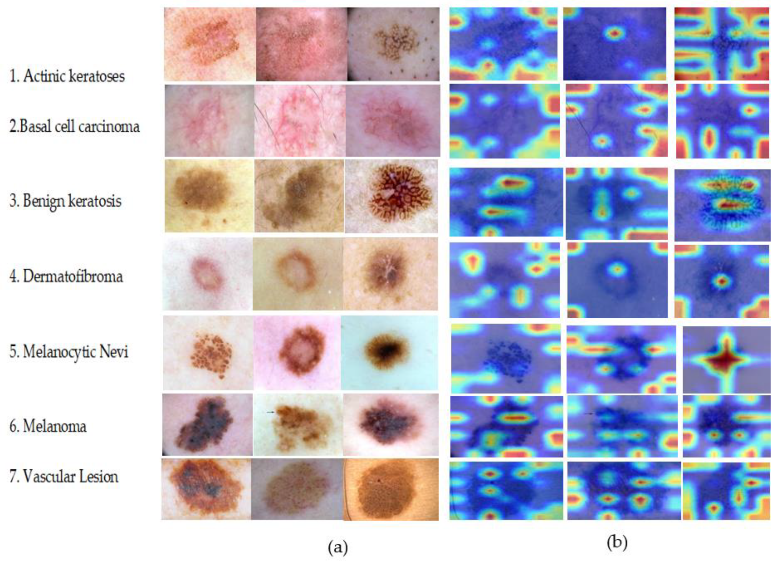 Diagnostics 13 00385 g015 Diagnostics 13 00385 g015