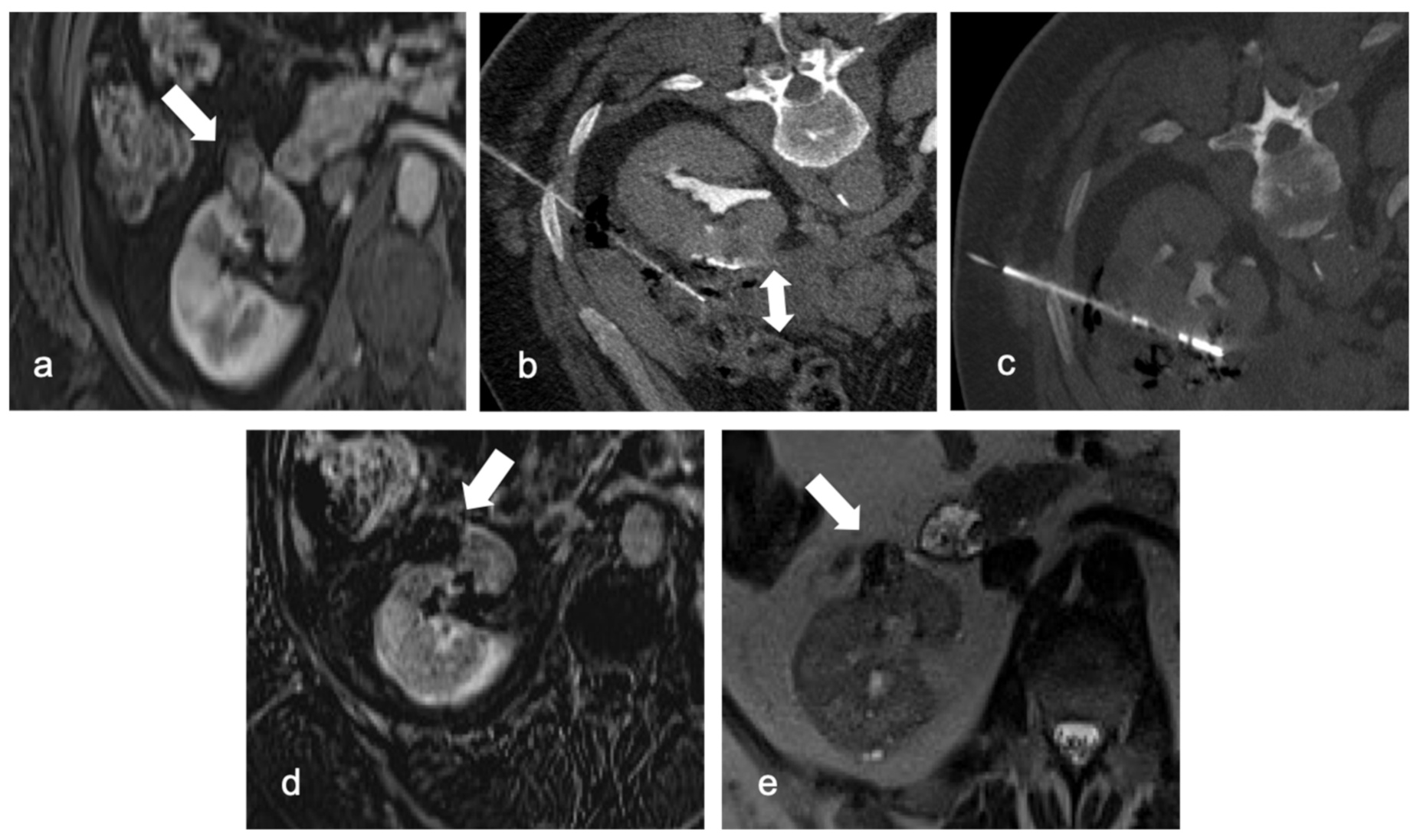 Diagnostics 13 00388 g003