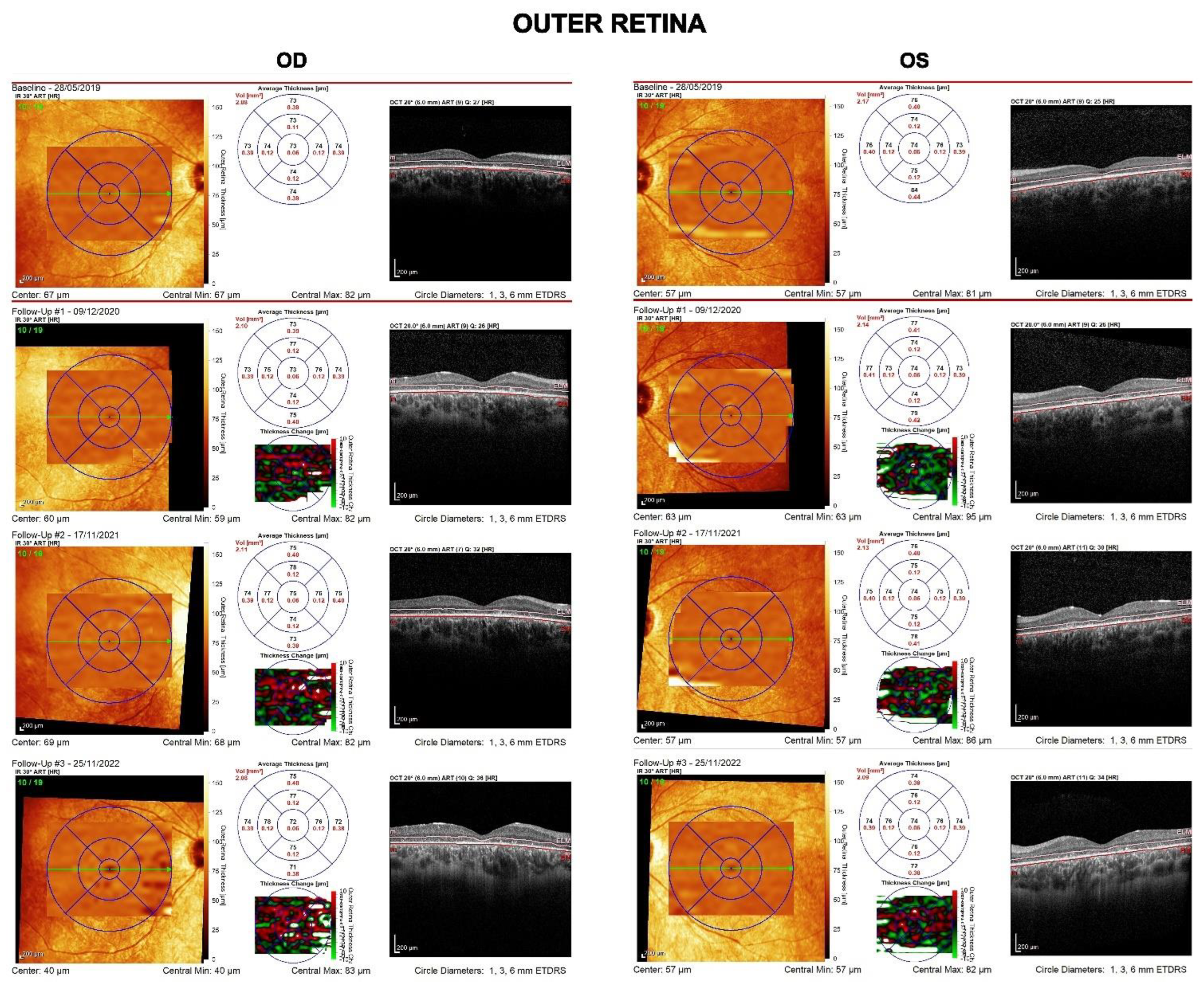 Diagnostics 13 00392 g003