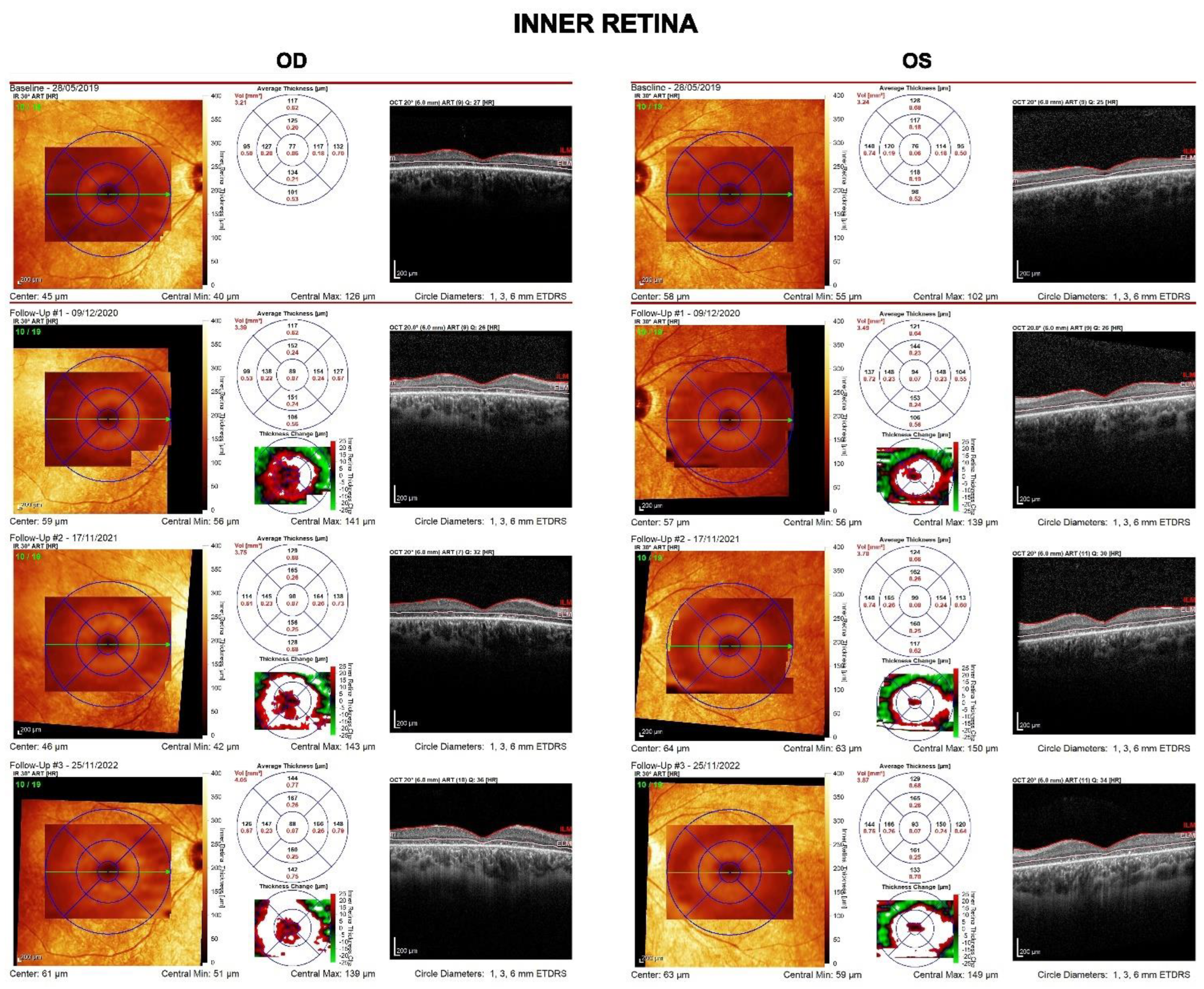 Diagnostics 13 00392 g004