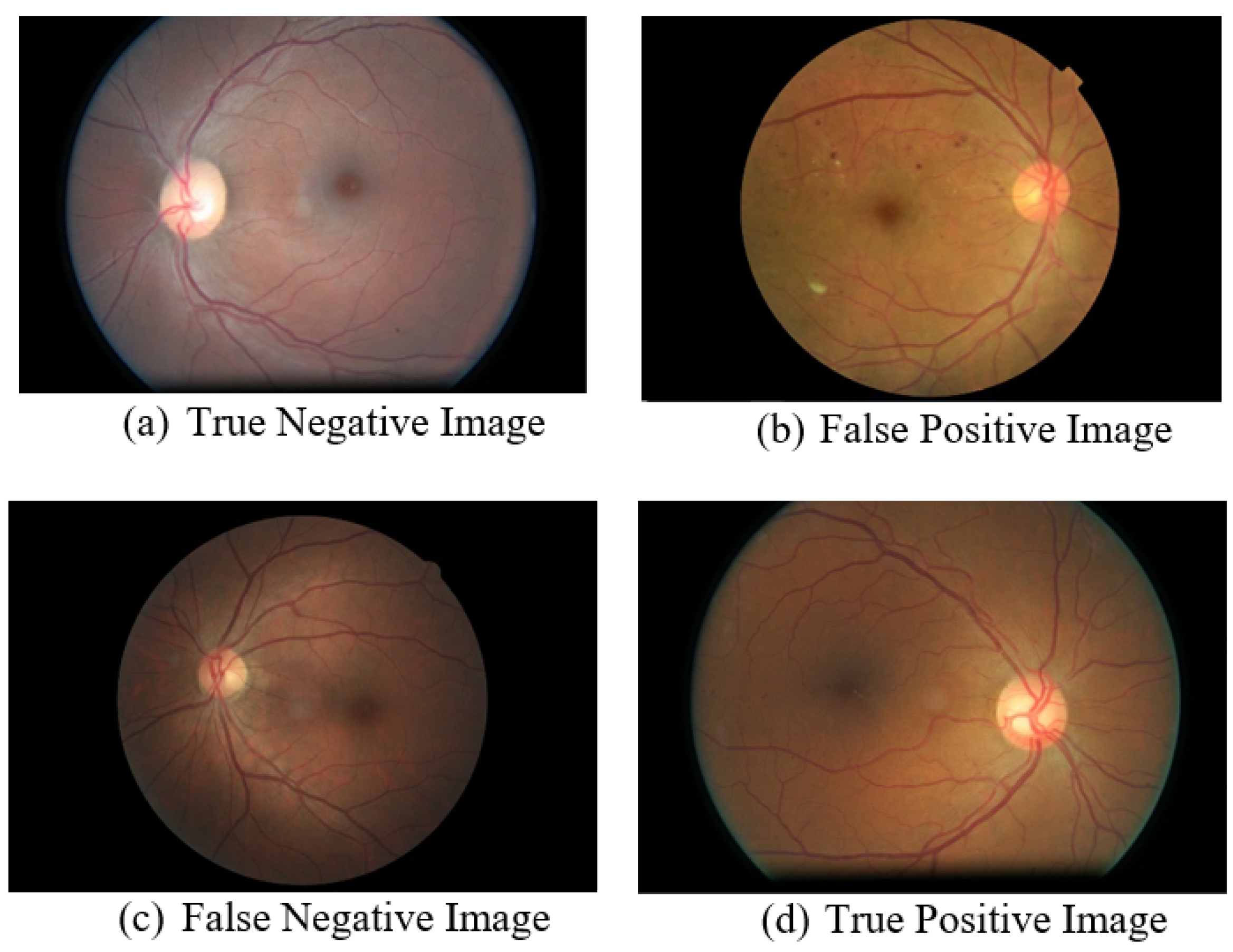 Diagnostics 13 00393 g004