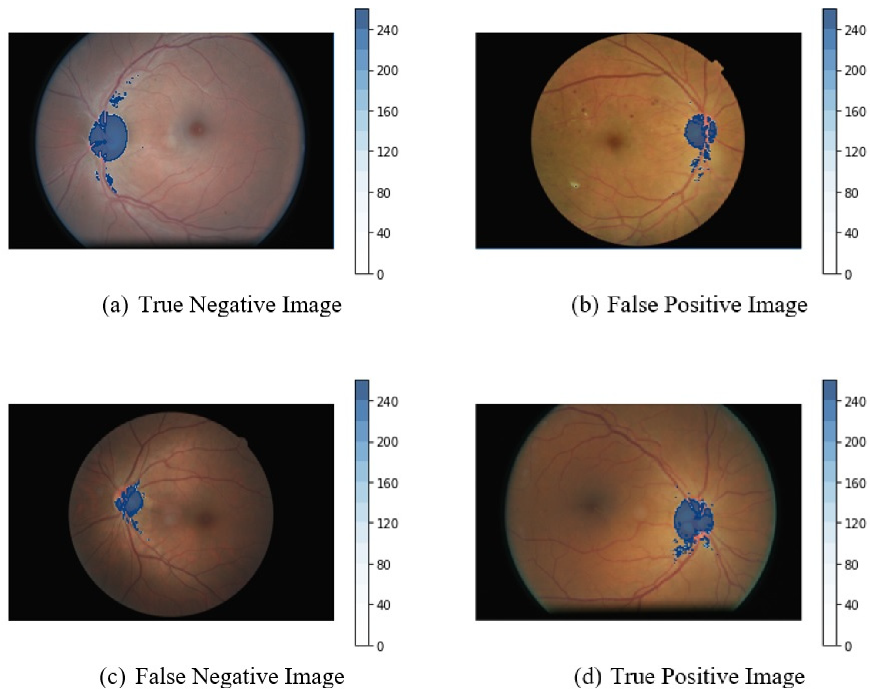 Diagnostics 13 00393 g005