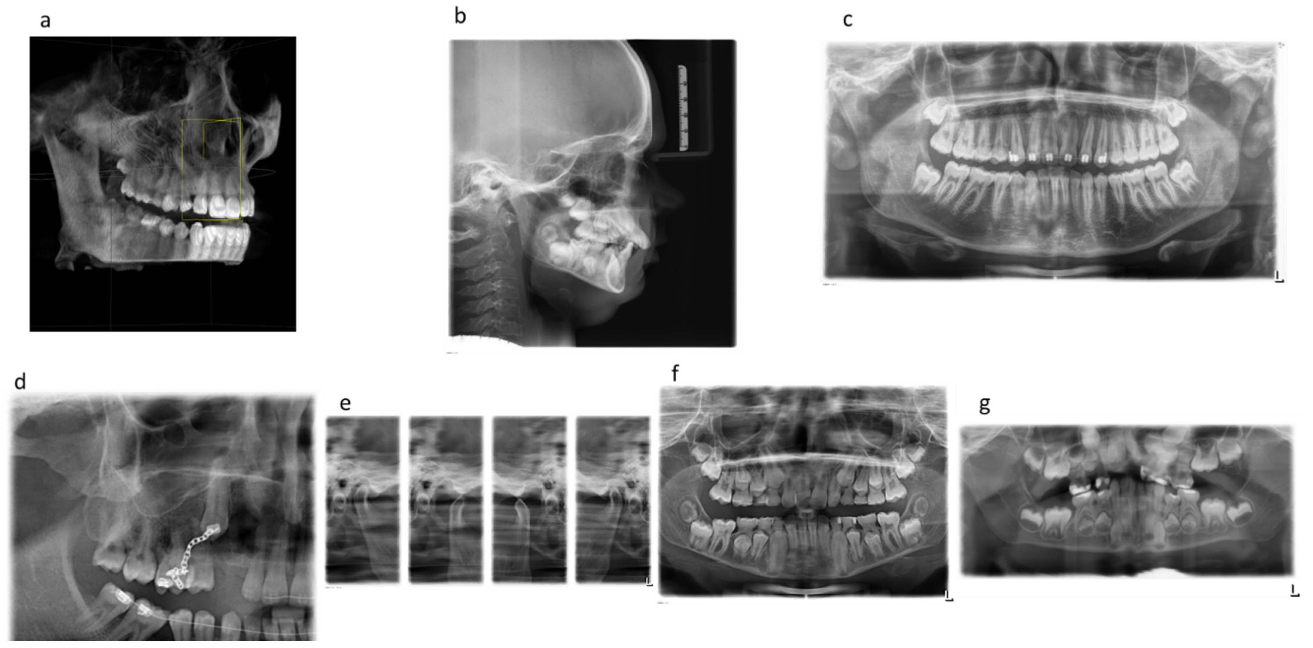 Diagnostics Free FullText Frequency of Dental Xray Diagnostics in