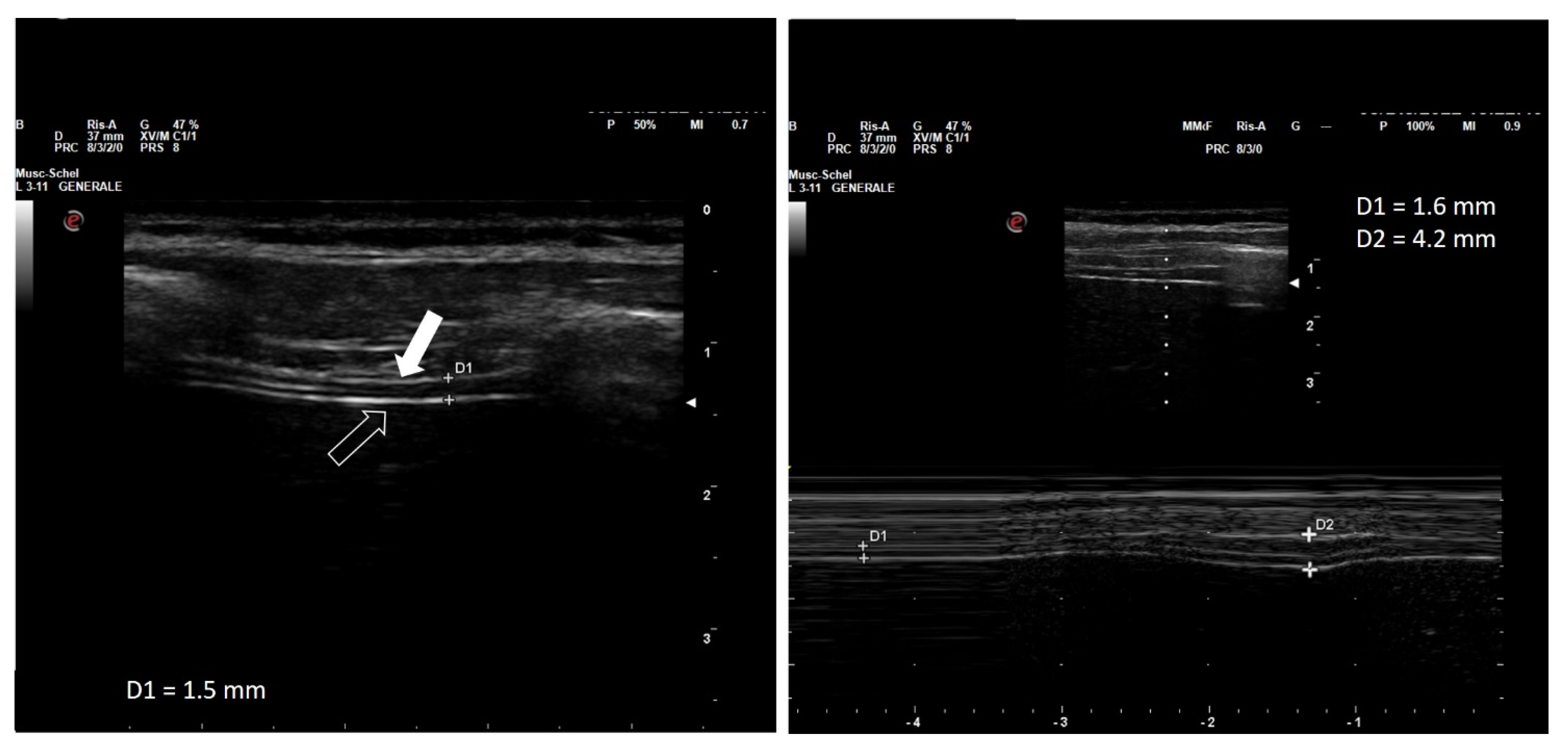 Diagnostics 13 00411 g001