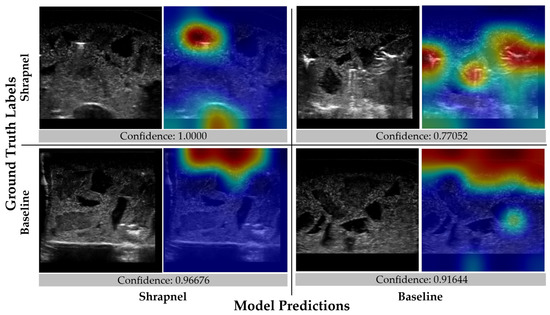 Using Ultrasound Image Augmentation and Ensemble Predictions to Prevent ...