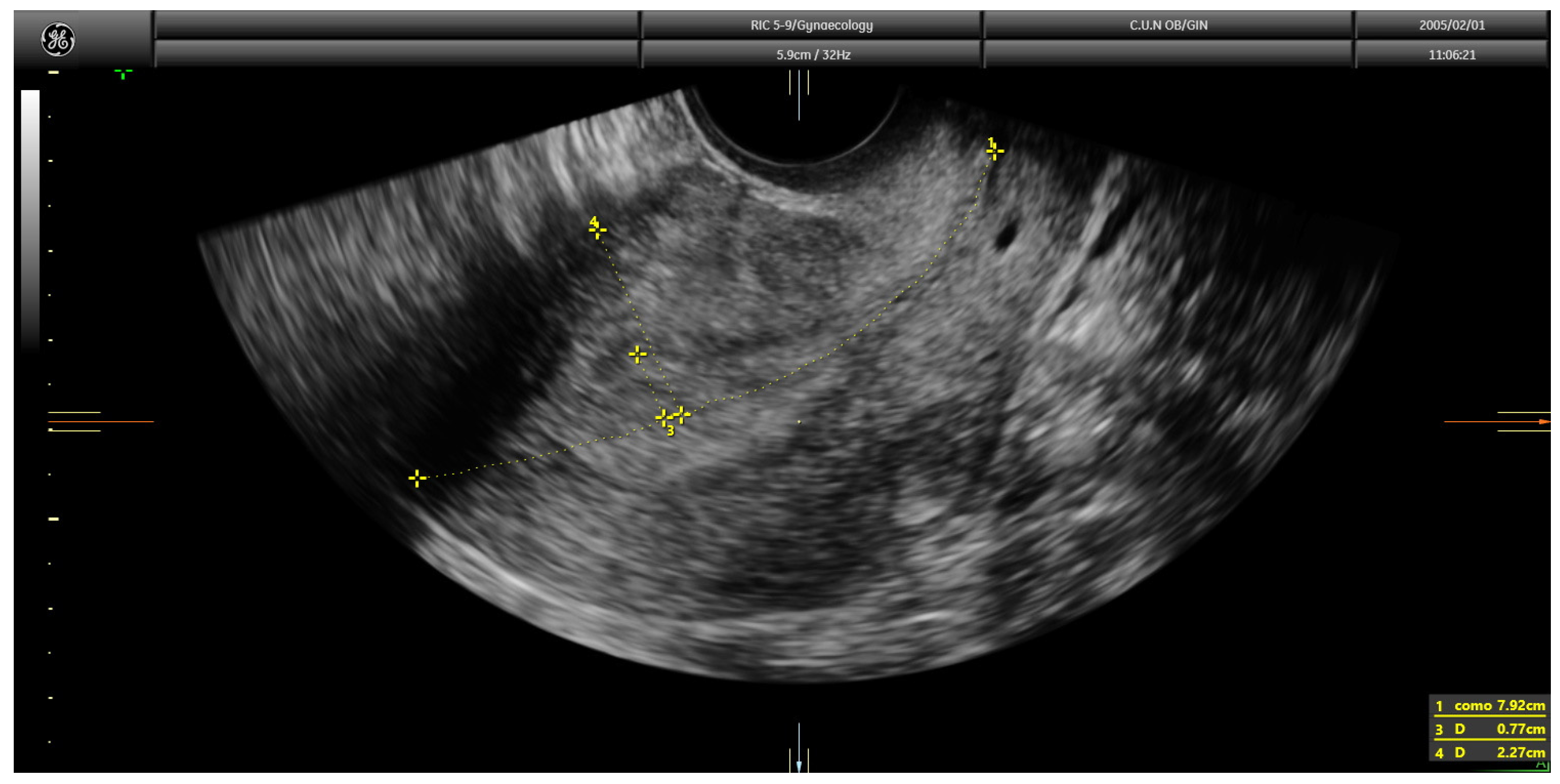 Diagnostics Free FullText Learning Curve for Ultrasound Assessment
