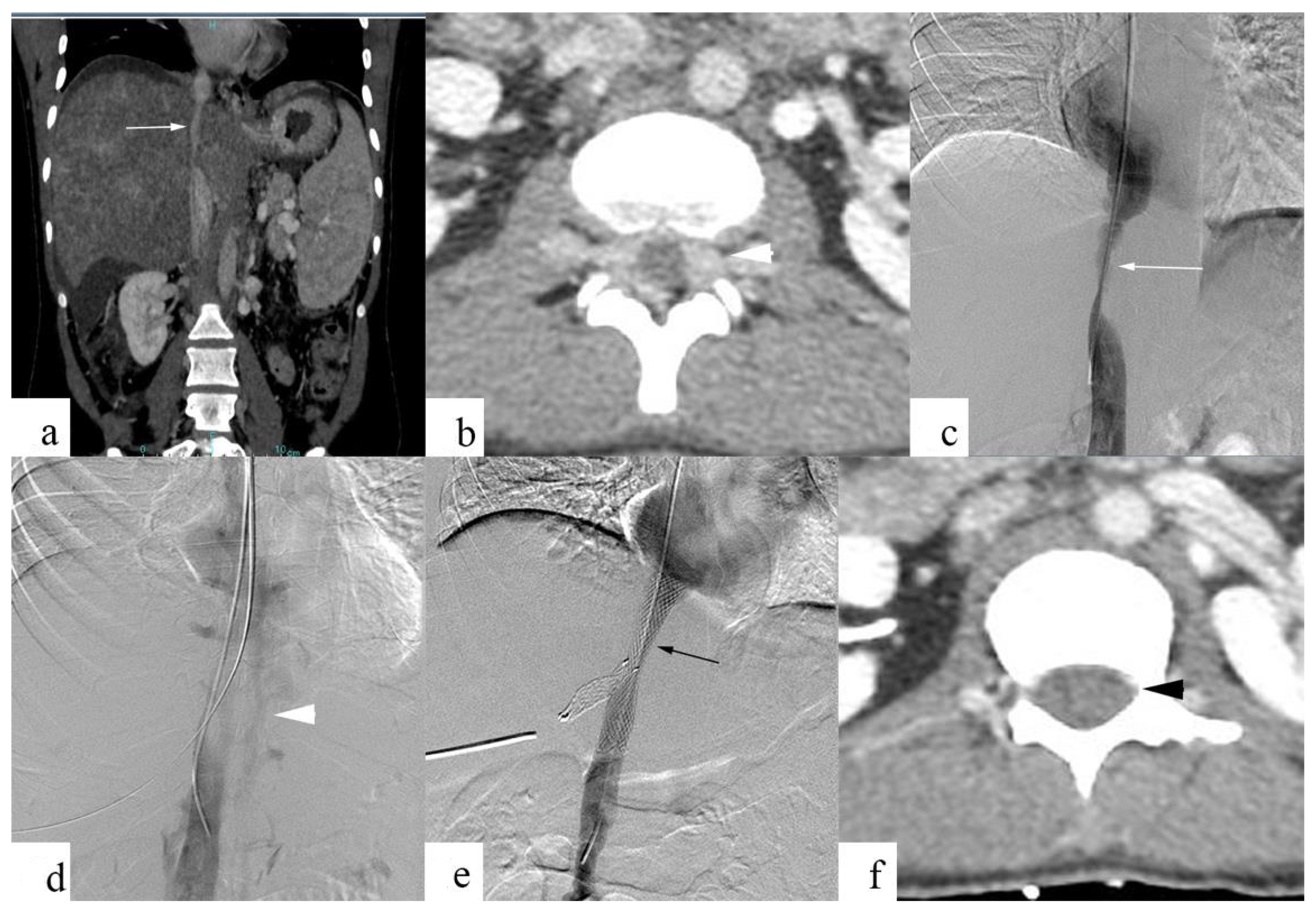 Diagnostics 13 00438 g004