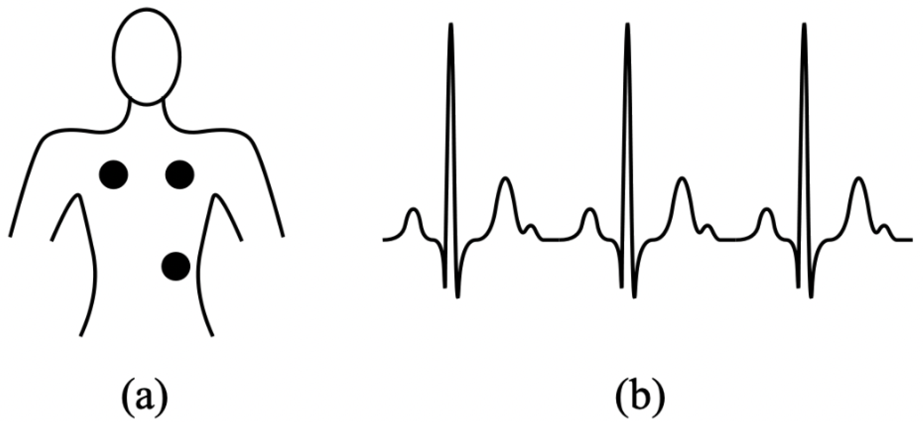 Electrocardiogram (ECG)-Based User Authentication Using Deep Learning ...