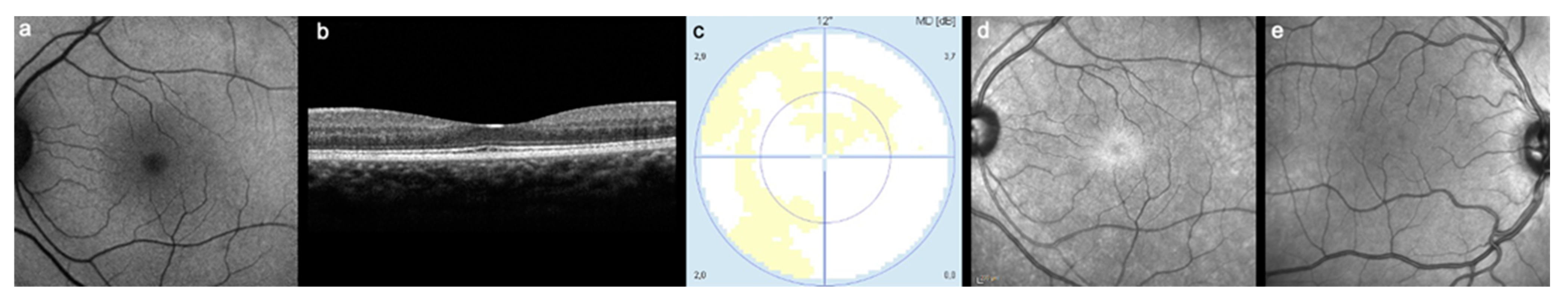 Diagnostics 13 00445 g002 Diagnostics 13 00445 g002