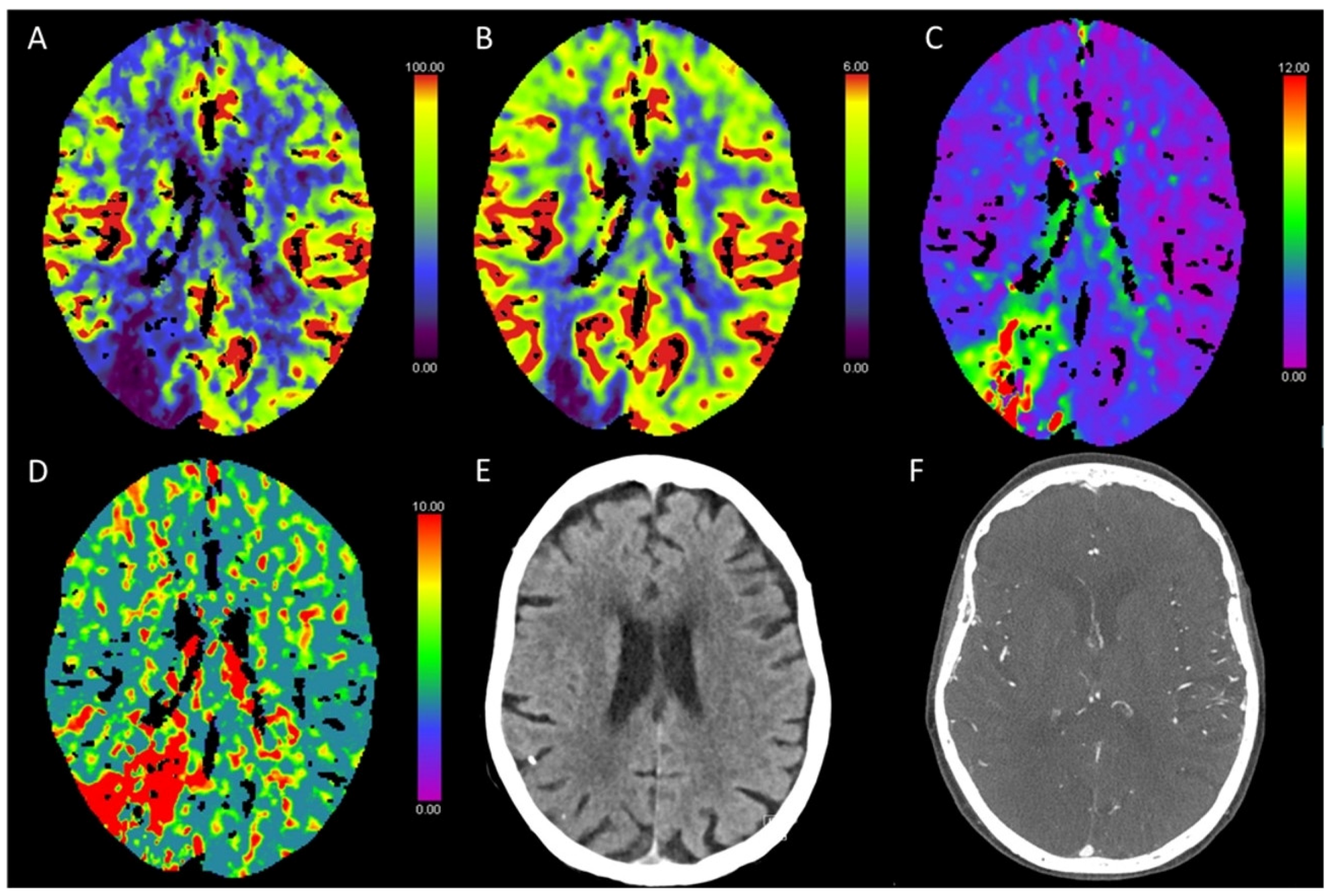 Diagnostics 13 00447 g002 Diagnostics 13 00447 g002