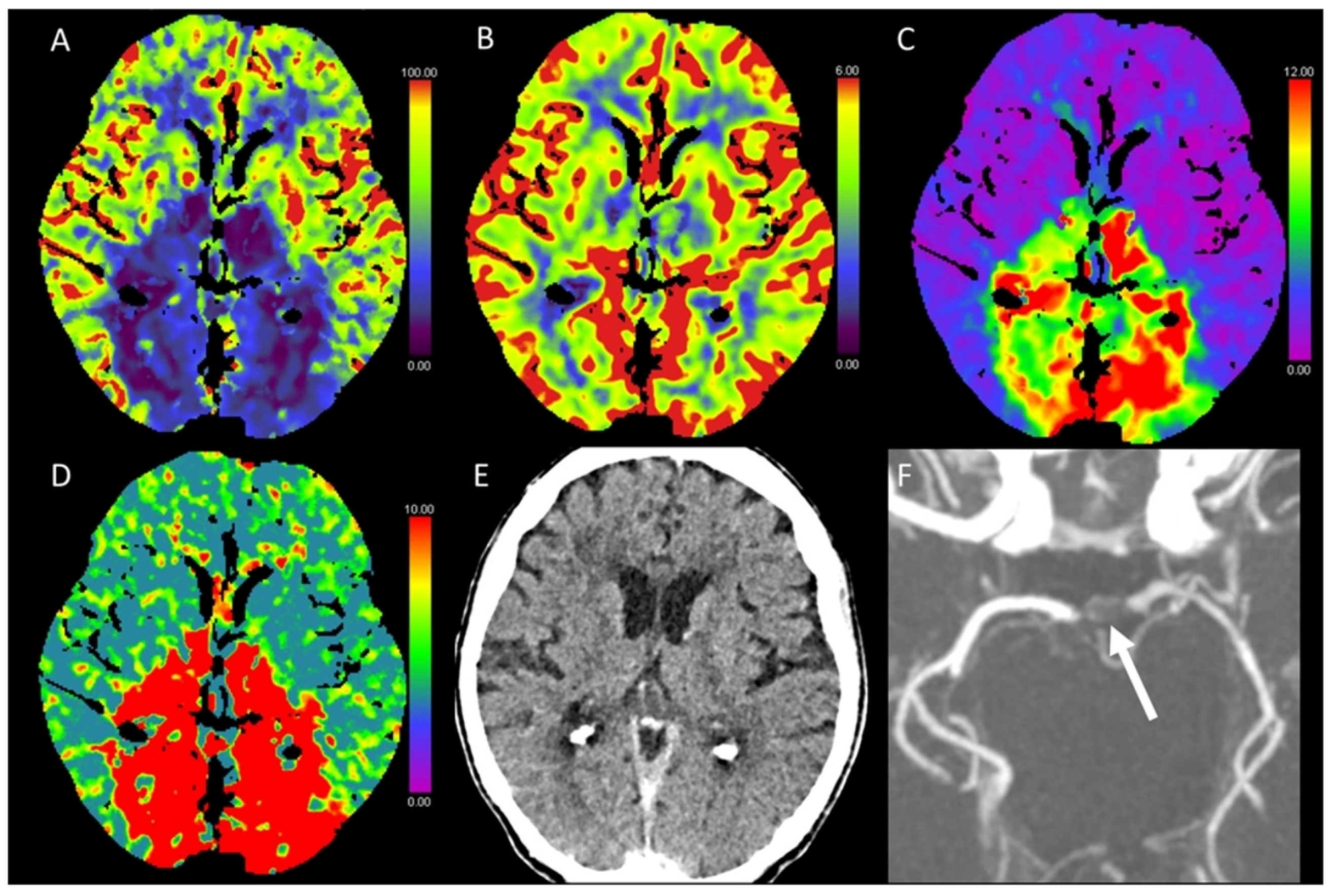 Diagnostics 13 00447 g003 Diagnostics 13 00447 g003