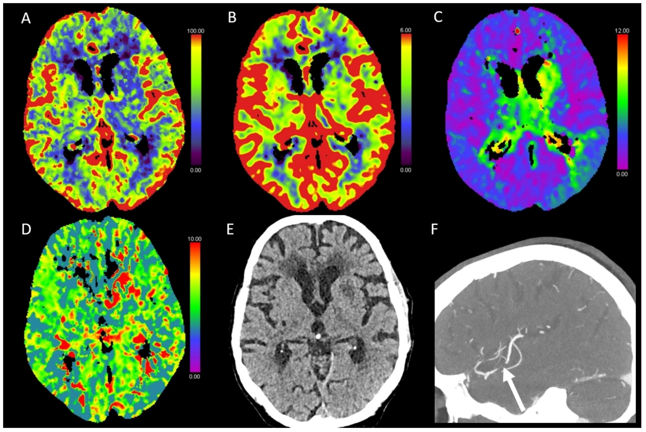 Diagnostics 13 00447 g004 Diagnostics 13 00447 g004