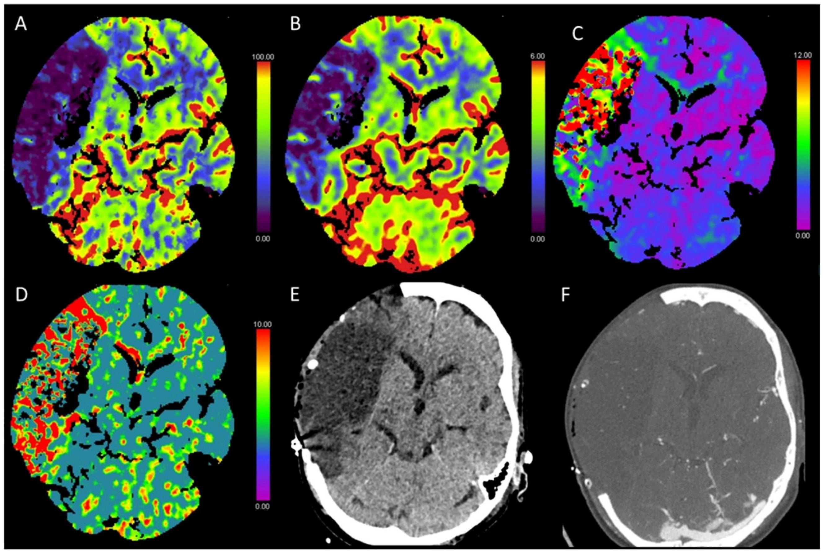 Diagnostics 13 00447 g005 Diagnostics 13 00447 g005