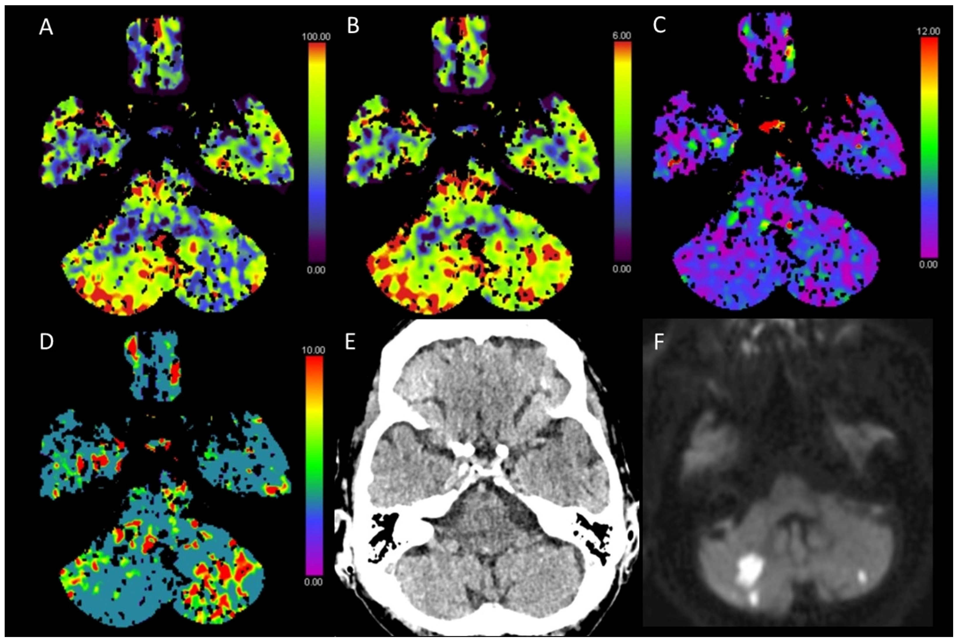 Diagnostics 13 00447 g006 Diagnostics 13 00447 g006
