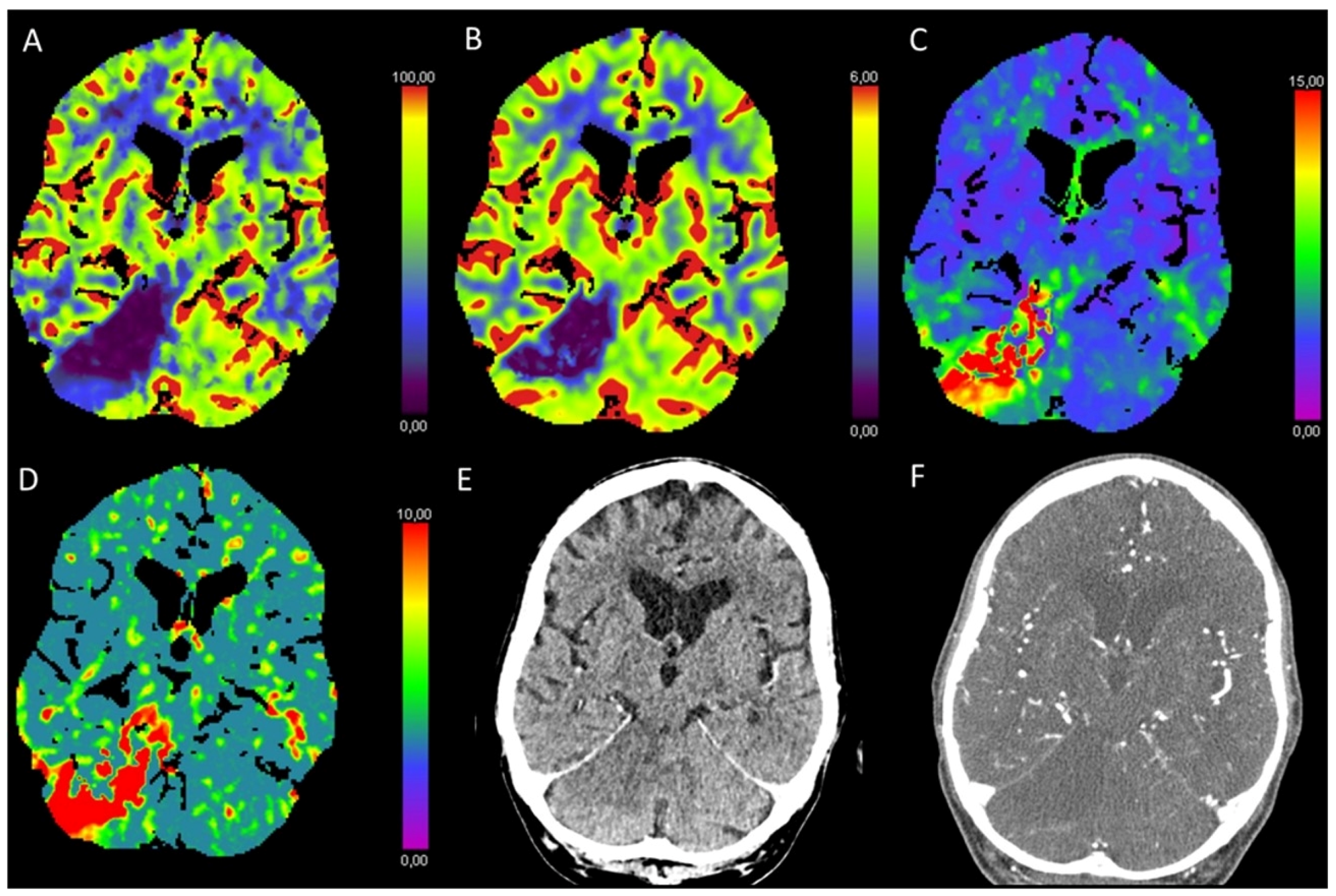 Diagnostics 13 00447 g007 Diagnostics 13 00447 g007