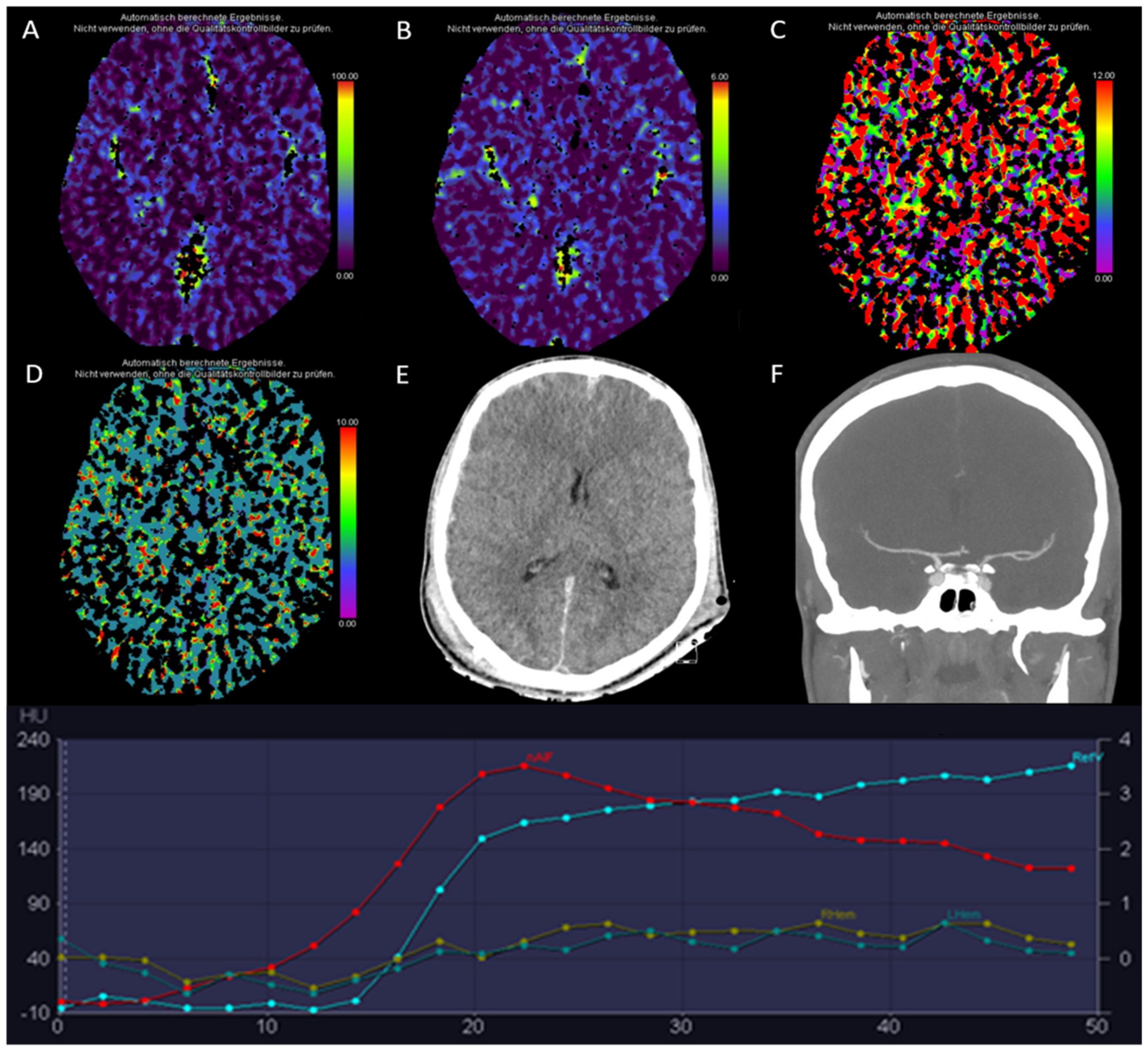 Diagnostics 13 00447 g008 Diagnostics 13 00447 g008