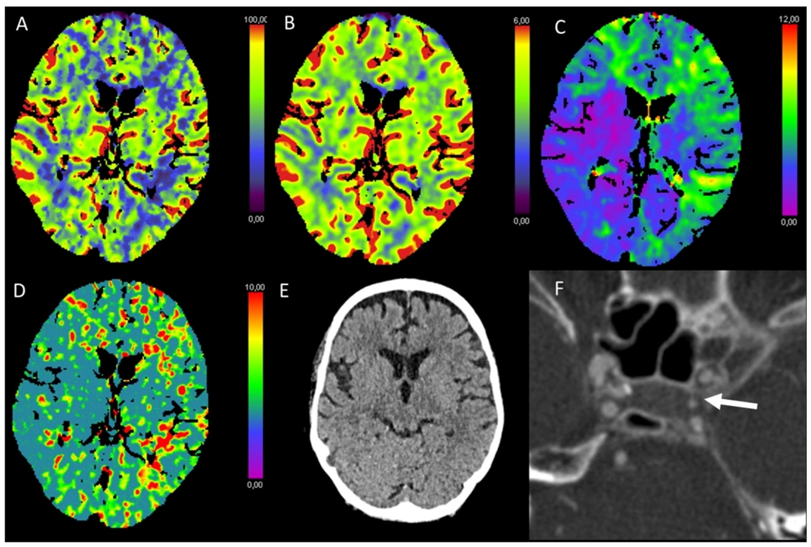 Diagnostics 13 00447 g009 Diagnostics 13 00447 g009