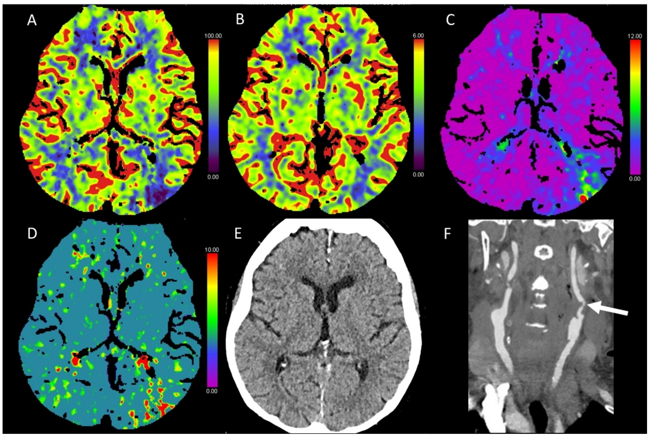 Diagnostics 13 00447 g010 Diagnostics 13 00447 g010